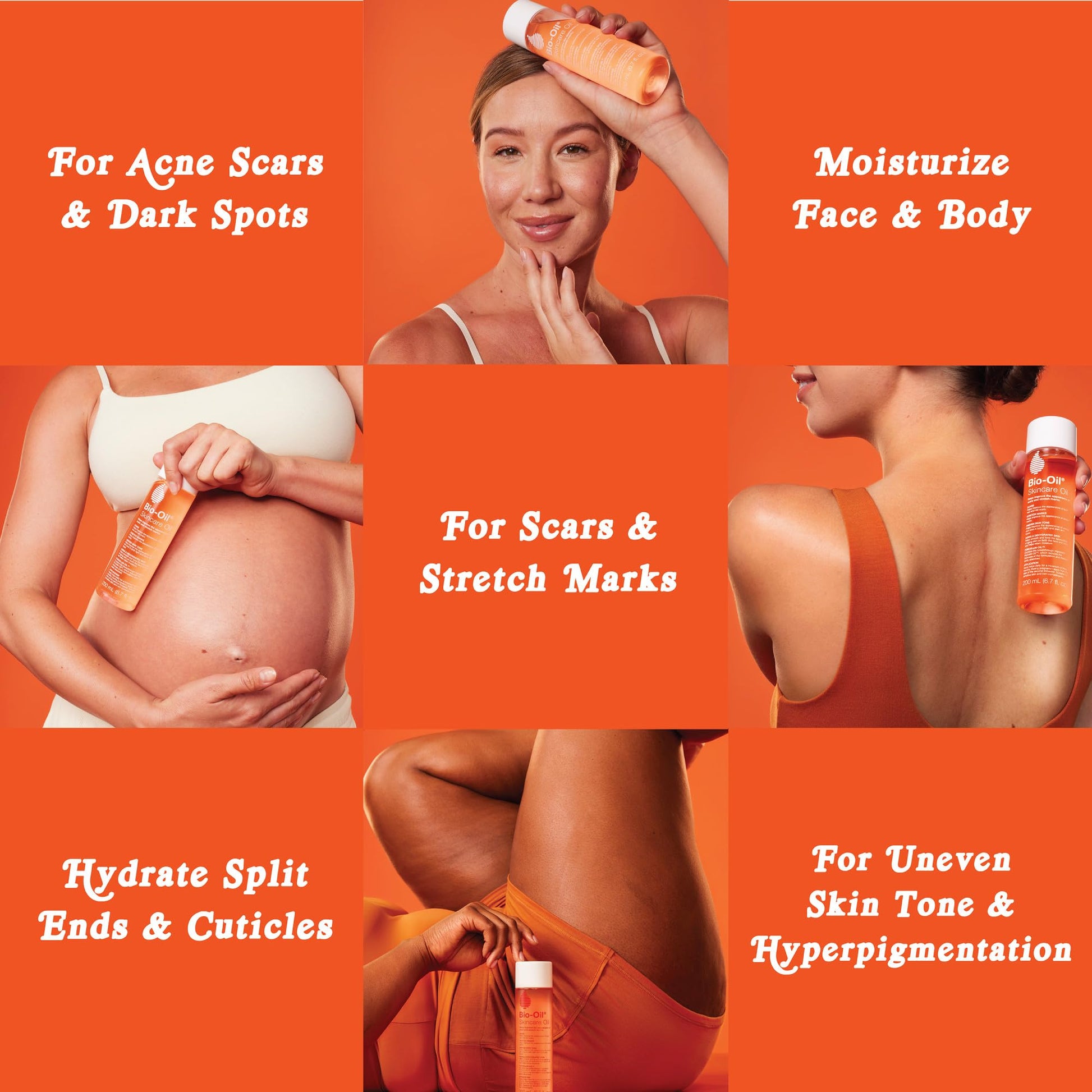 Bio-Oil® 6.7oz: Multiuse Skincare Oil