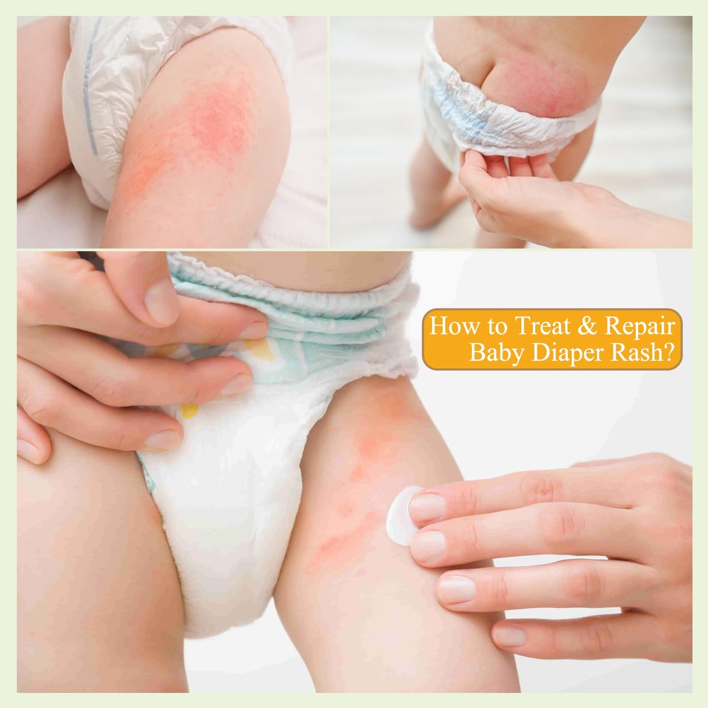 AOAO Crema para la dermatitis del pañal en bebés: recomendada por pediatras para prevenir, aliviar y tratar brotes y brotes de dermatitis del pañal. Protege la piel del bebé (100 ml, 3.38 onzas líquid