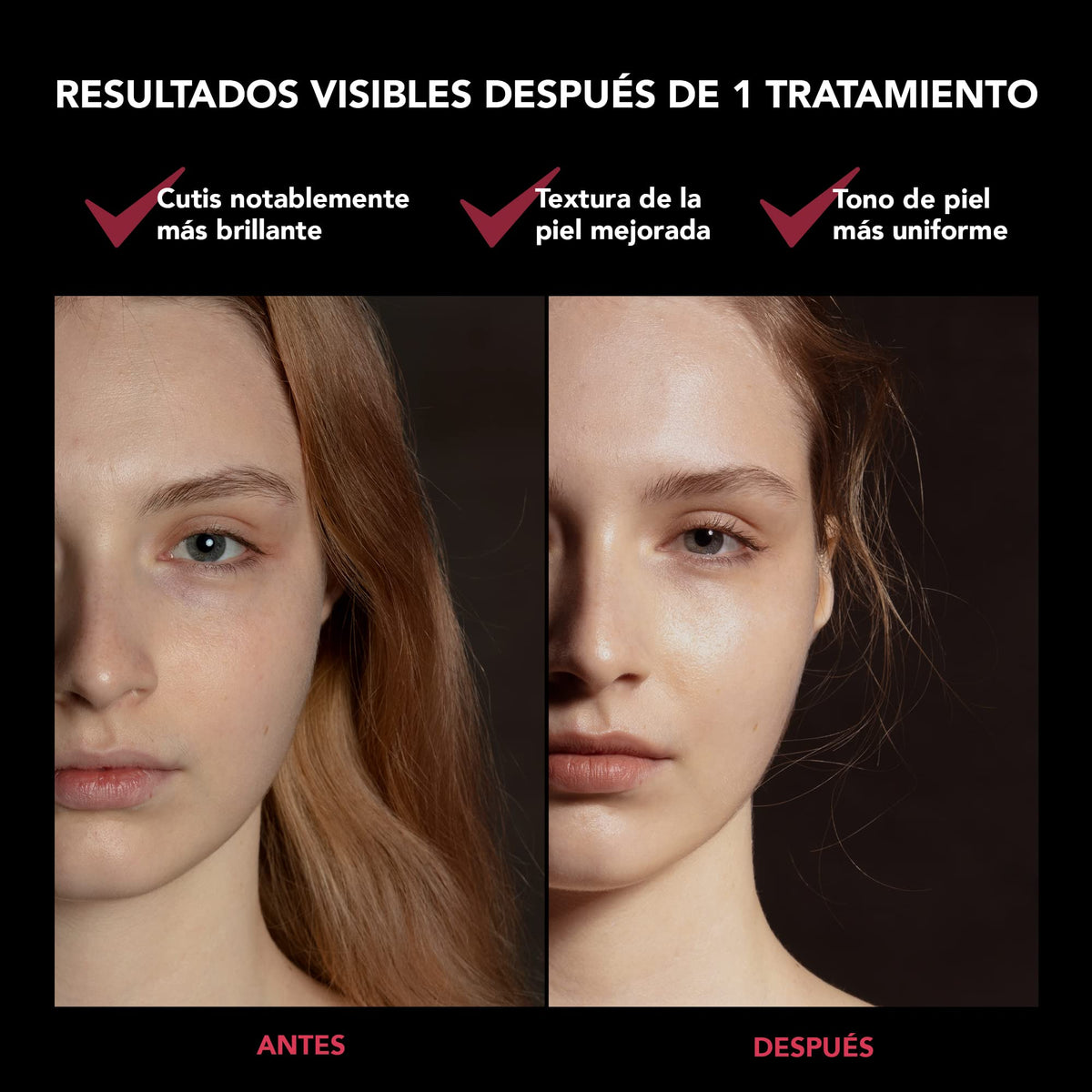 FAQ 201 - Máscara facial con luces LED RGB avanzadas, para manchas y acné suave, máscaras faciales para el cuidado de la piel, máscaras faciales inalámbricas de belleza, 600 puntos de resplandor
