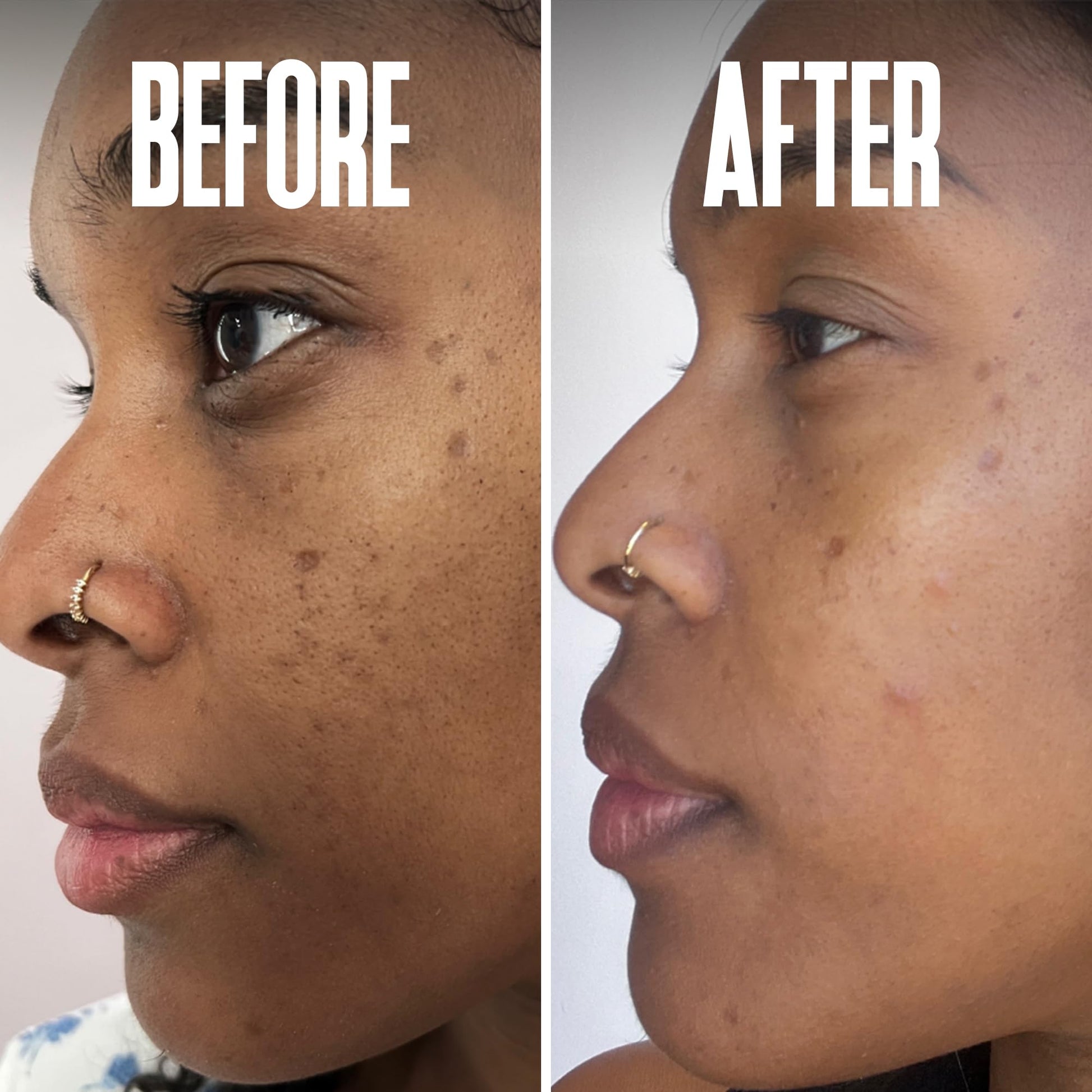 Divine Derriere Skin Lightening 2% Hydroquinone Dark Spot Corrector For Face & Melasma Treatment Fade Cream - Contains Vitamin C, Salicylic Acid, Kojic Acid, Azelaic Acid and Lactic Acid 1.0 oz / 30ml