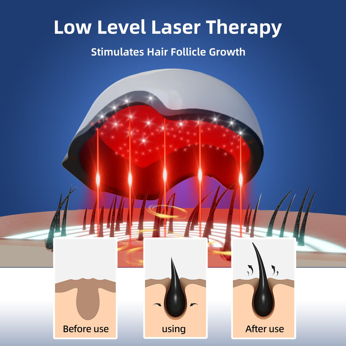 Gorro Láser faq101 Negro para la Regeneración Capilar en Alopecia para Hombre y Mujer