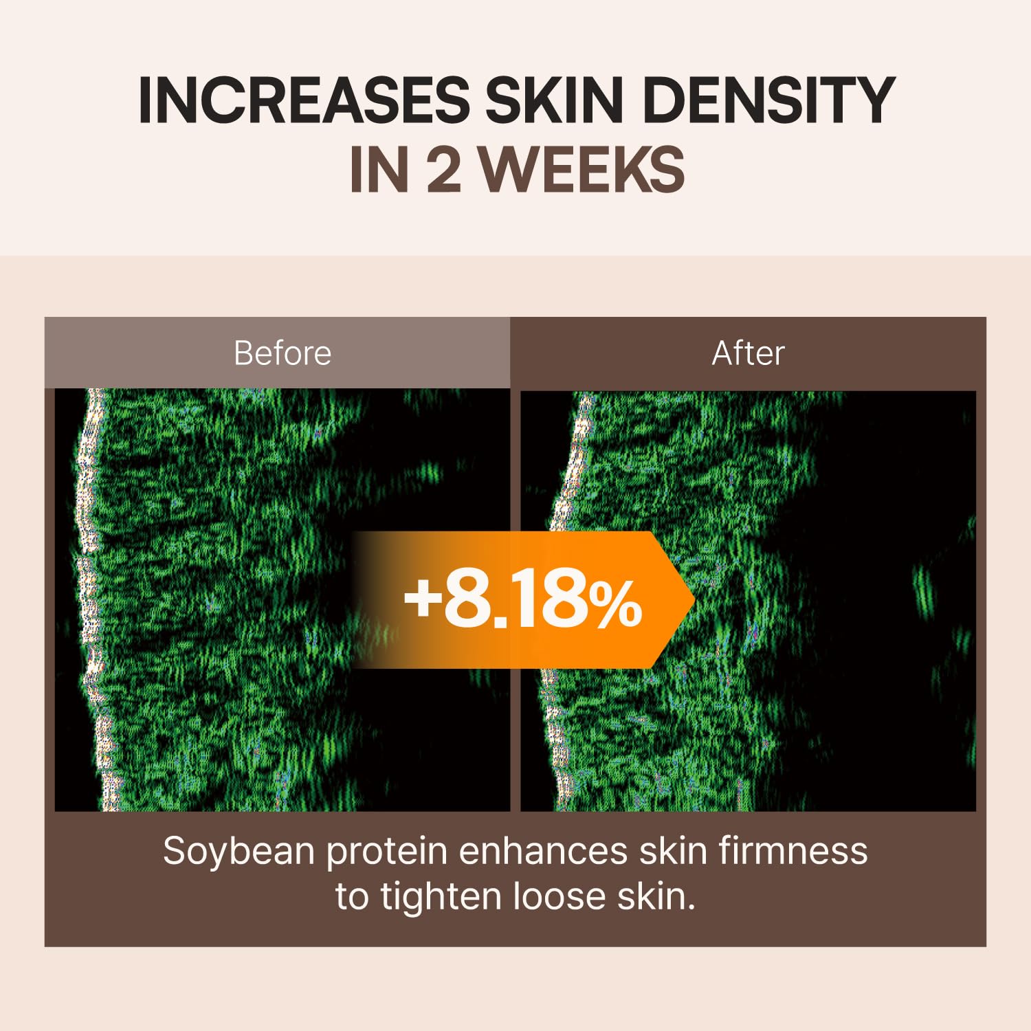 FLASKIN Esencia de proteína de soja elástica 80 ml