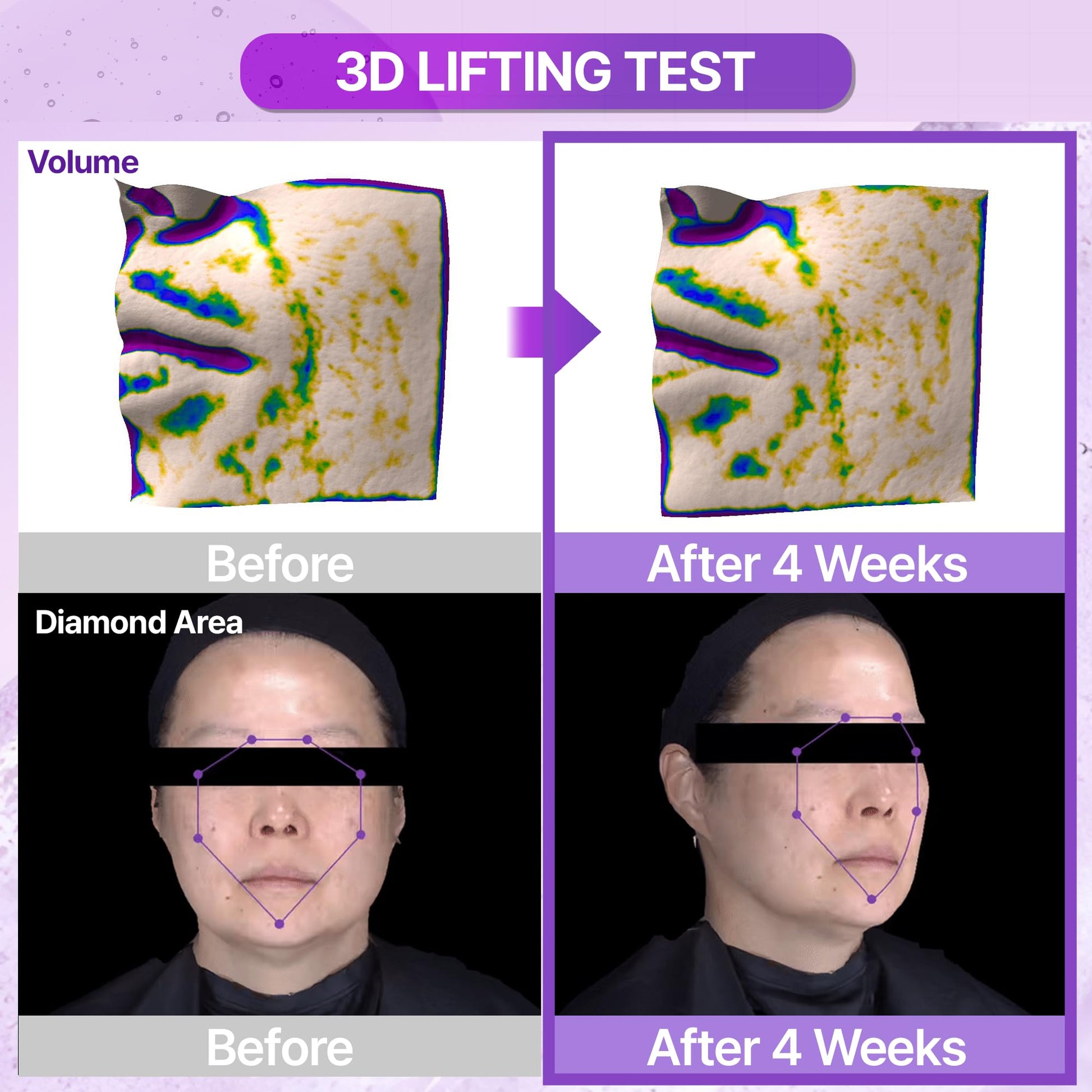 Suero reafirmante 3D Probioderm™ | Fórmula avanzada con probióticos y péptidos | Piel esculpida y firme | 30 ml