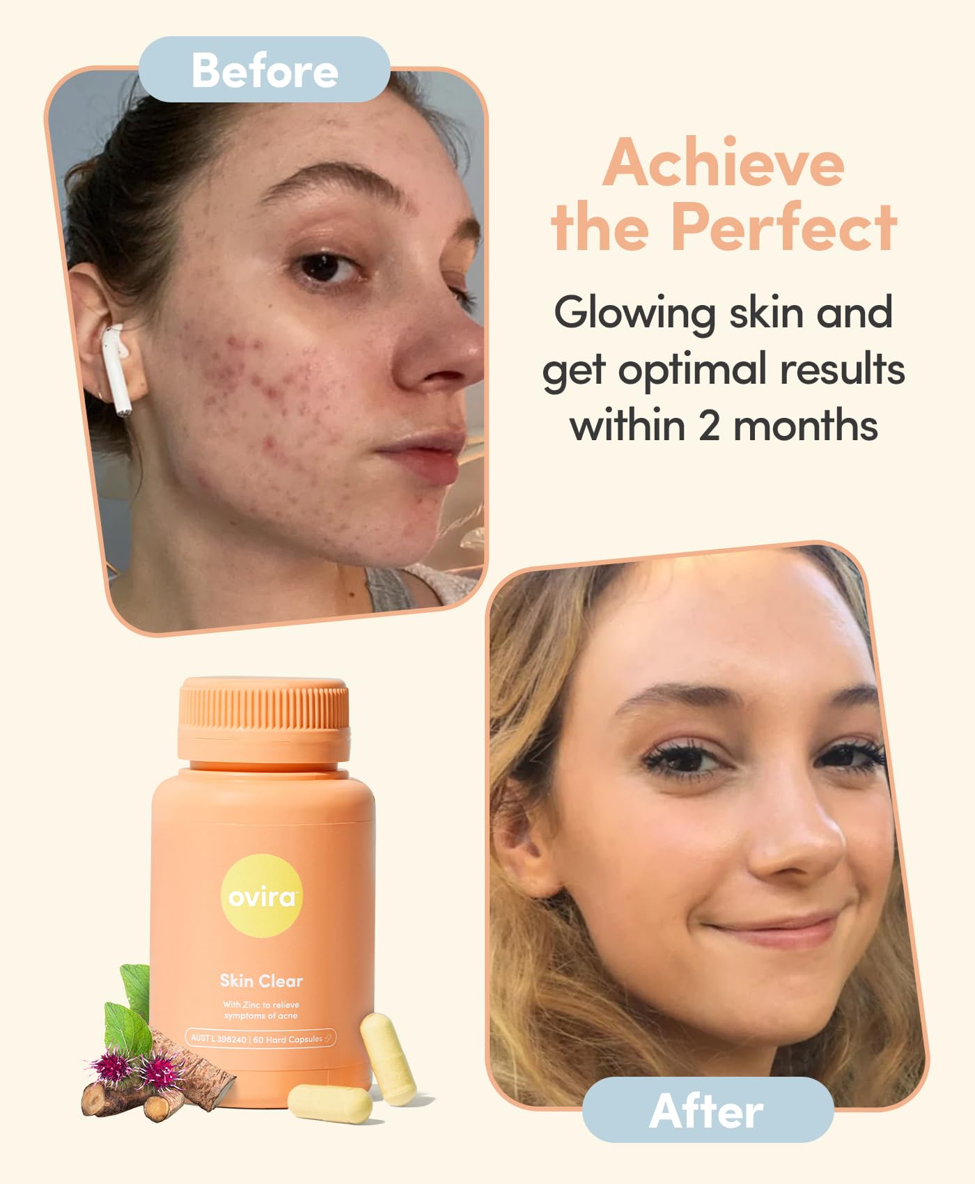 Ovira- “Skin Clear con ZINCBRIGHT 60 Cápsulas para Piel Clara y Brillante | Rosácea y Hormonal Acné Trea