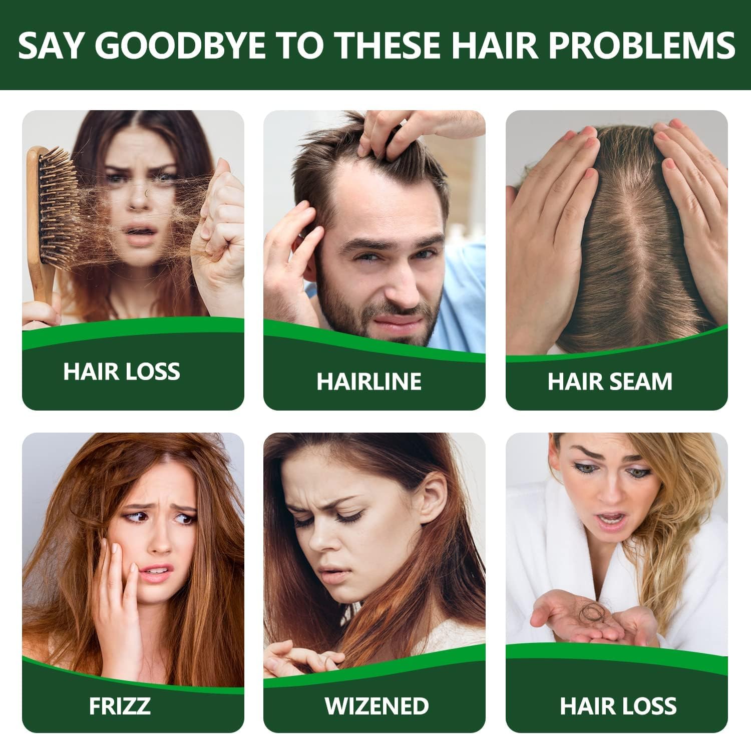 Pack de 3 Aceites Esenciales de Romero para Estimular el Crecimiento del Cabello Seco - 30ml. ¡Potencia la salud capilar con esta fórmula natural!