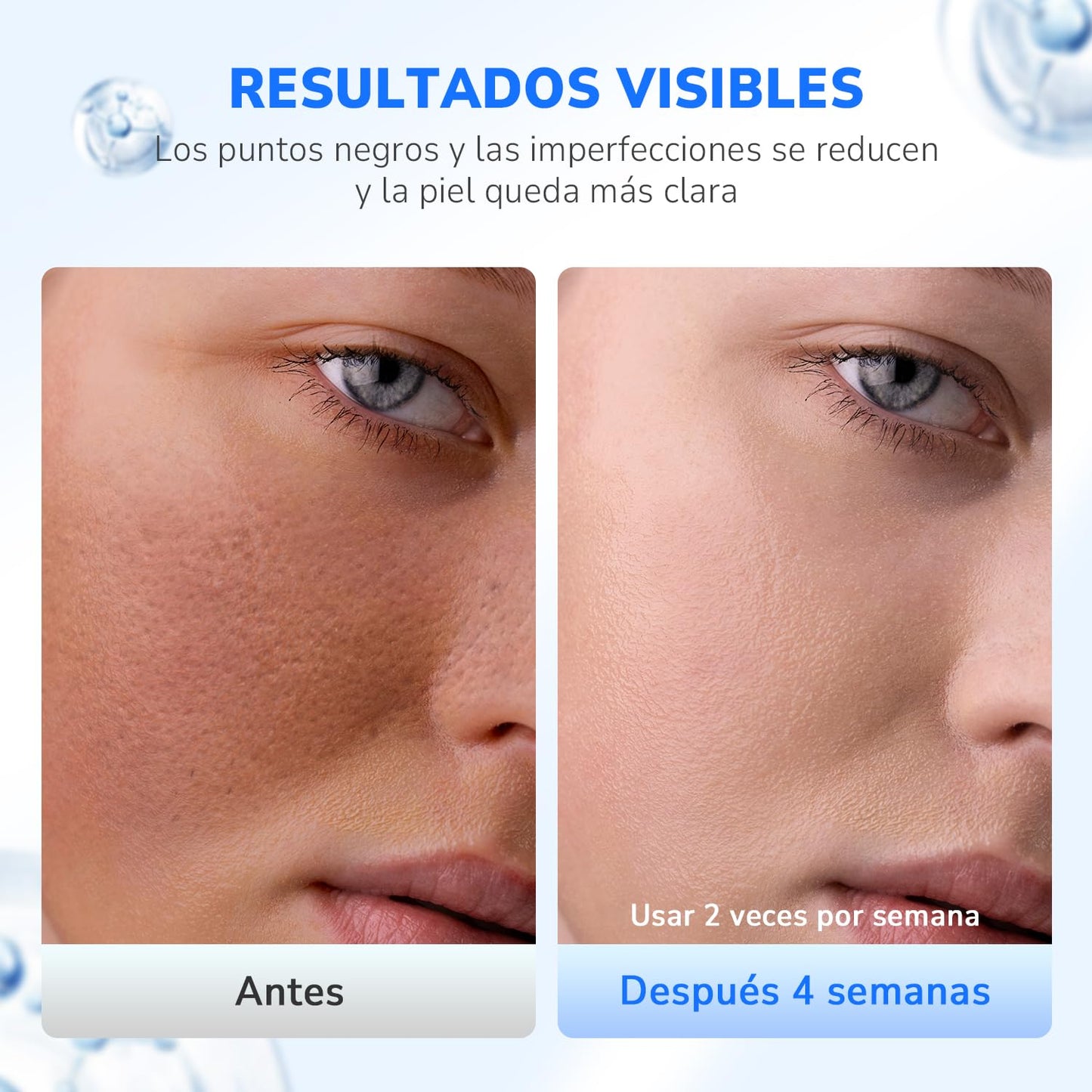 MITEGELO Vaporizador Facial, Sauna Facial de Nano Iónico