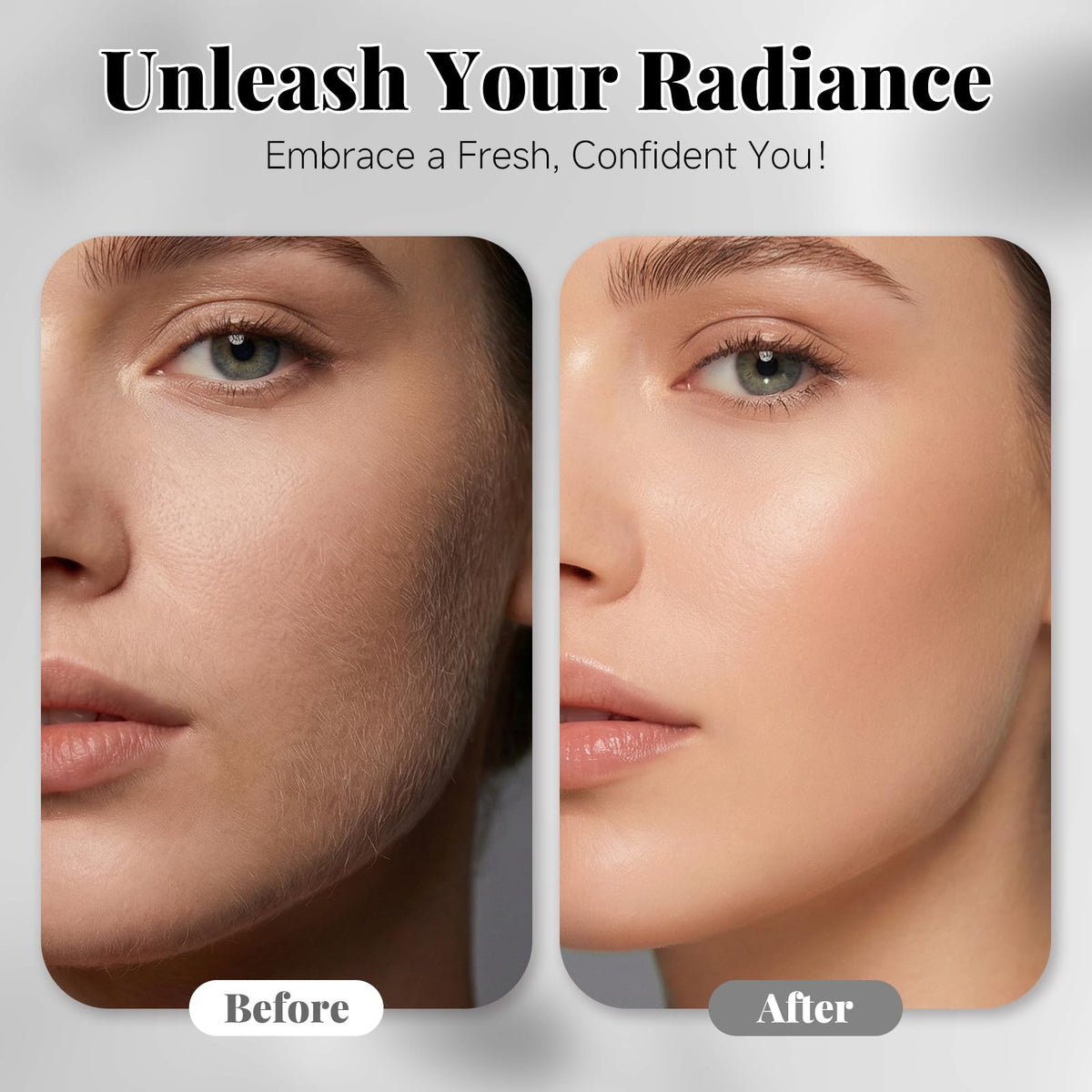 Sonic Dermaplane - Maquinilla de afeitar para mujer, herramienta de dermatiamiento recargable con 8 cuchillas de dermatiamiento y aceite facial, 3 velocidades para eliminar pelusa de melocotón y