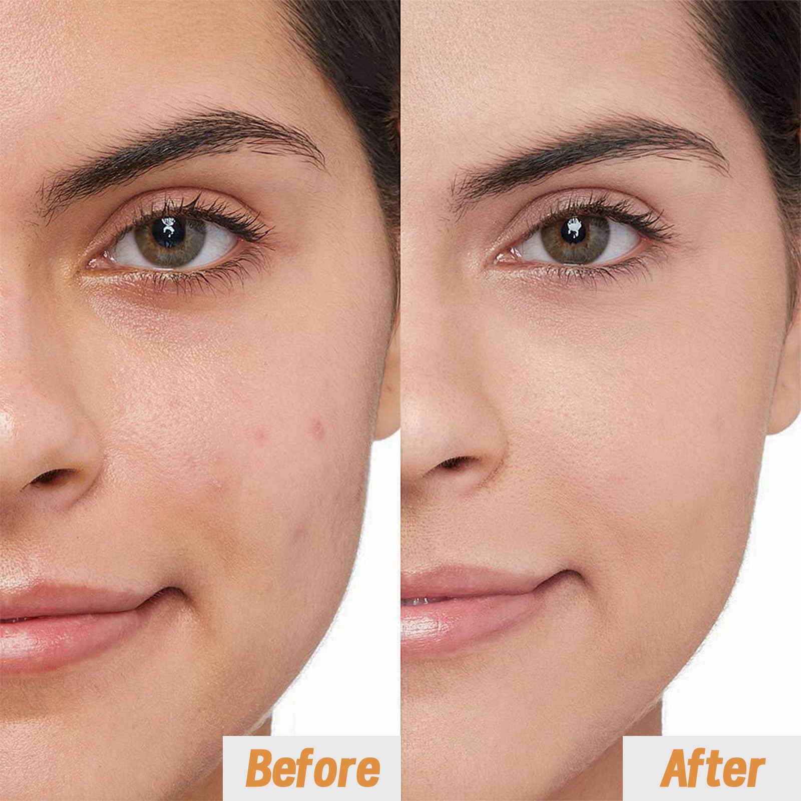 VGO- 【Hidratación profunda】El suero de vitamina C VGO proporciona una hidratación intensa que retiene la humedad, ayuda a equilibrar tu cutis, estimula el colágeno para una mejor vitalidad y reduce la