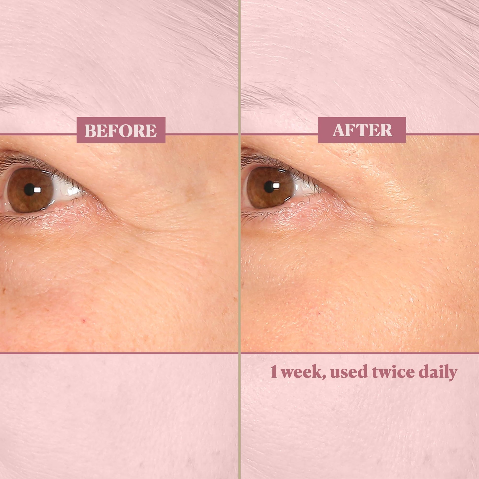 Nakery Beauty Retinol Cream - Crema Facial De Retinol Y Colágeno - Crema Facial De Colágeno Para Todo Tipo De Piel - Colágeno Retinol Crema De Ácido Hialurónico Para Arrugas - Crema