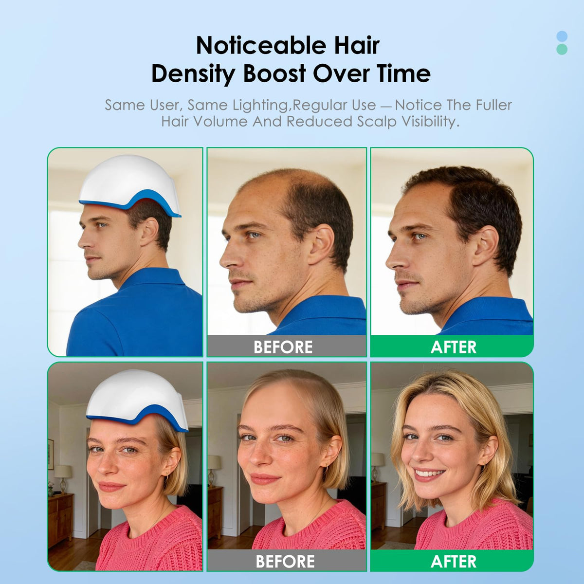 Dispositivo de Terapia de Luz Roja CWTUL Aprobado por la FDA para el Crecimiento del Cabello