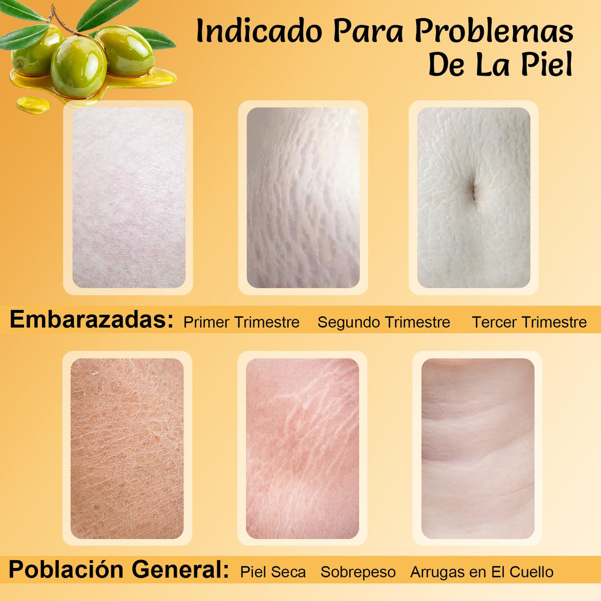 Aceite Corporal de Oliva Orgánico Para el Cuidado de Las Estrías,Hidrata y Nutre,Ligero y No Graso-120ml/4.06fi.oz