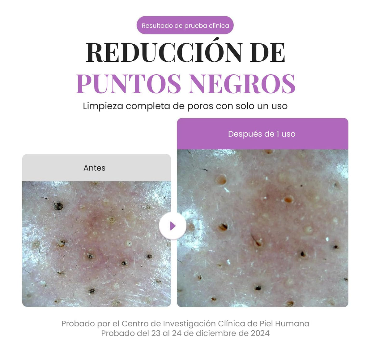 EQQUALBERRY Limpiador Facial 2 en 1 Mascarilla de Arcilla 130 g