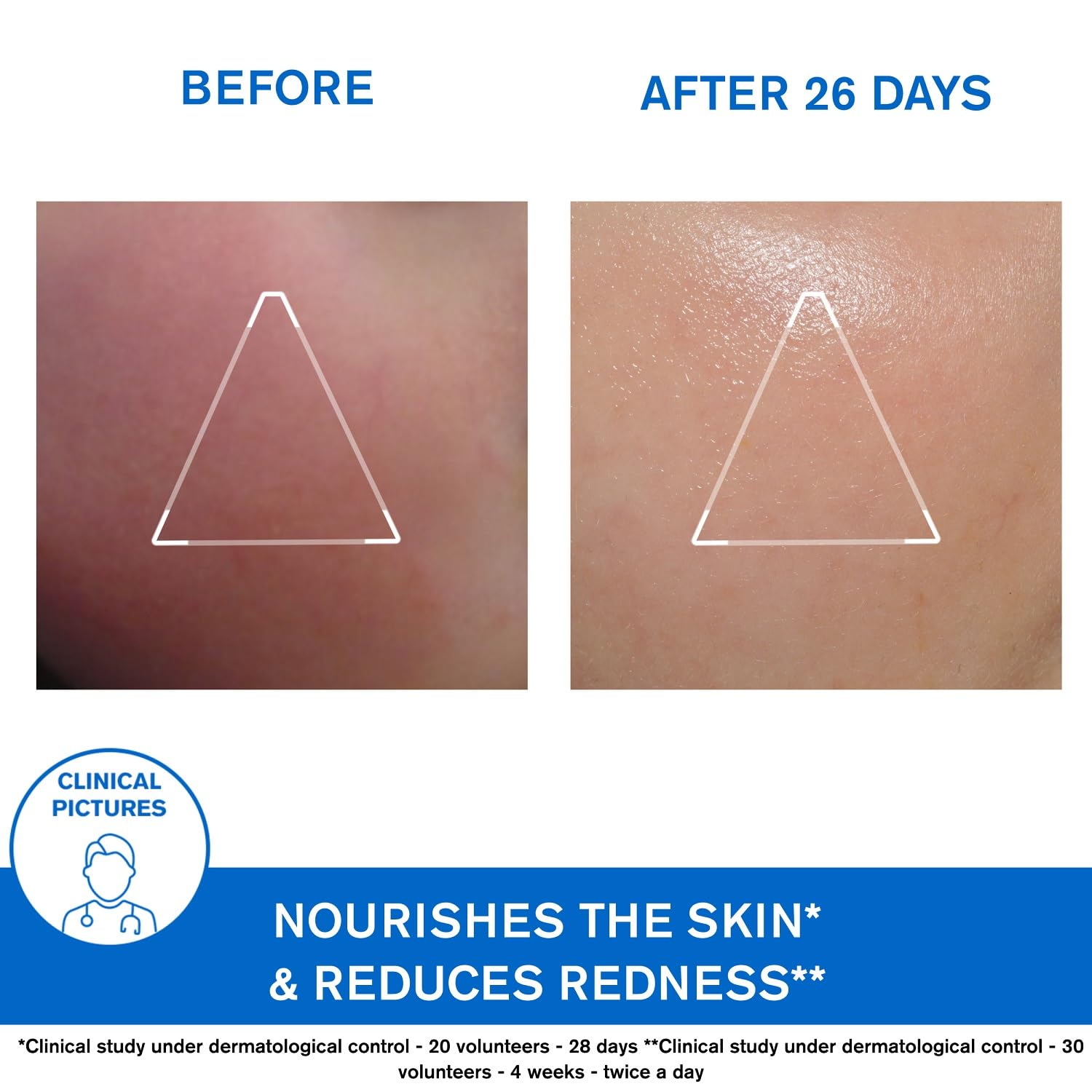 Uriage X?mose Face Cream 40ml by Uriage