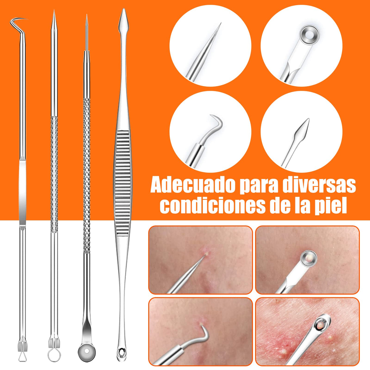 Kit Removedor de Espinillas, 20 Kits de Acero Inoxidable, Hombres y Mujeres