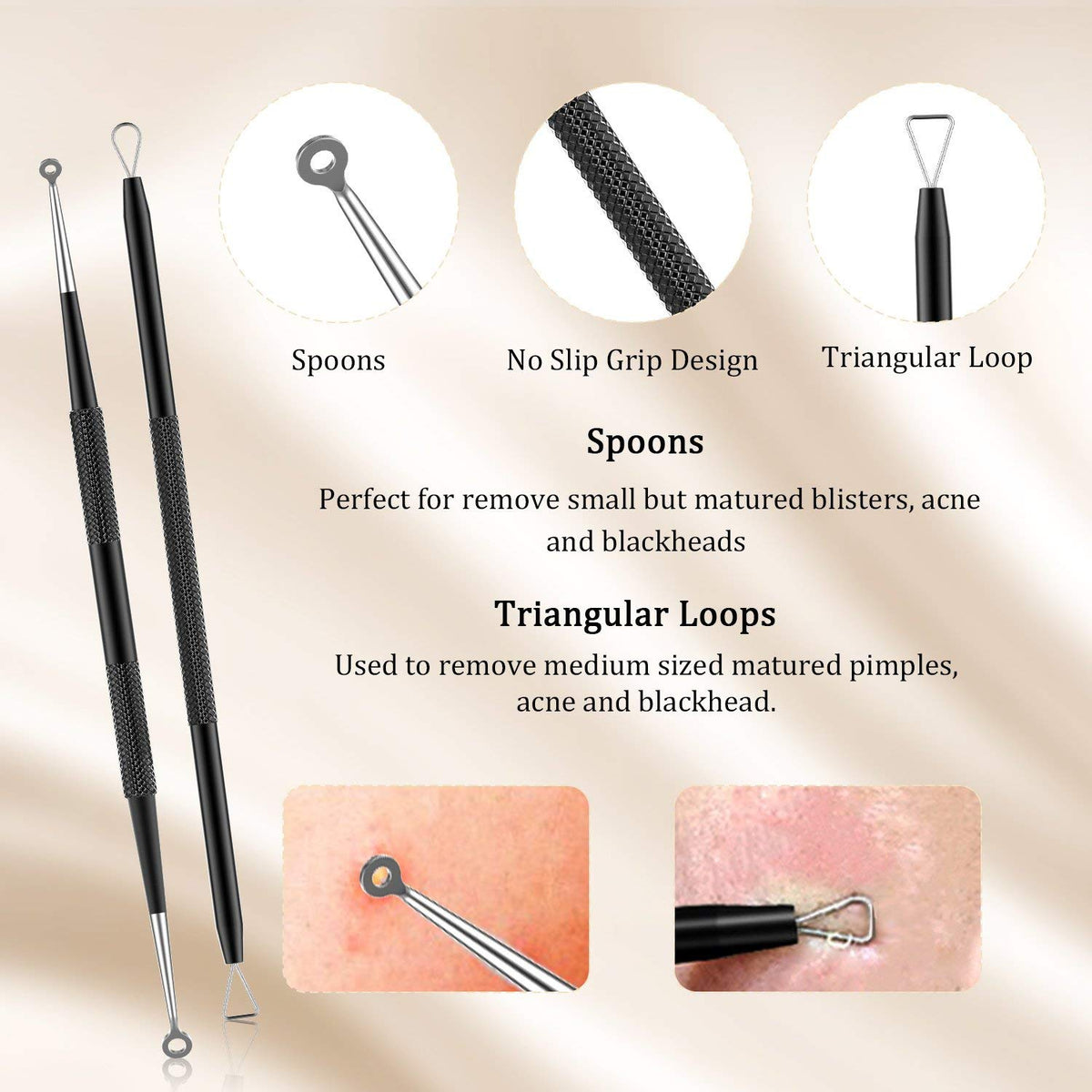 BESTOPE | Kit de herramientas para extracción de espinillas | Para rostro y nariz | 5 piezas distintas de acero inoxidable color negro.