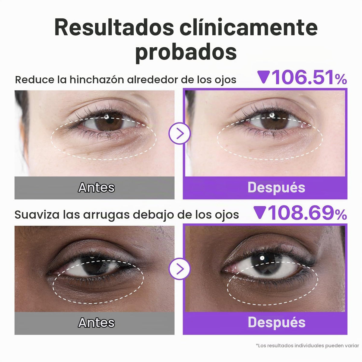 numbuzin Parches Para Ojos N.° 9 | Parches De Colágeno Nad+ Para El Contorno De Ojos | Ojeras, Efecto Refrescante, Reduce La Hinchazón, Arrugas Con Péptidos, Cafeína Y Niacinamida | Reafirmante Y Volu