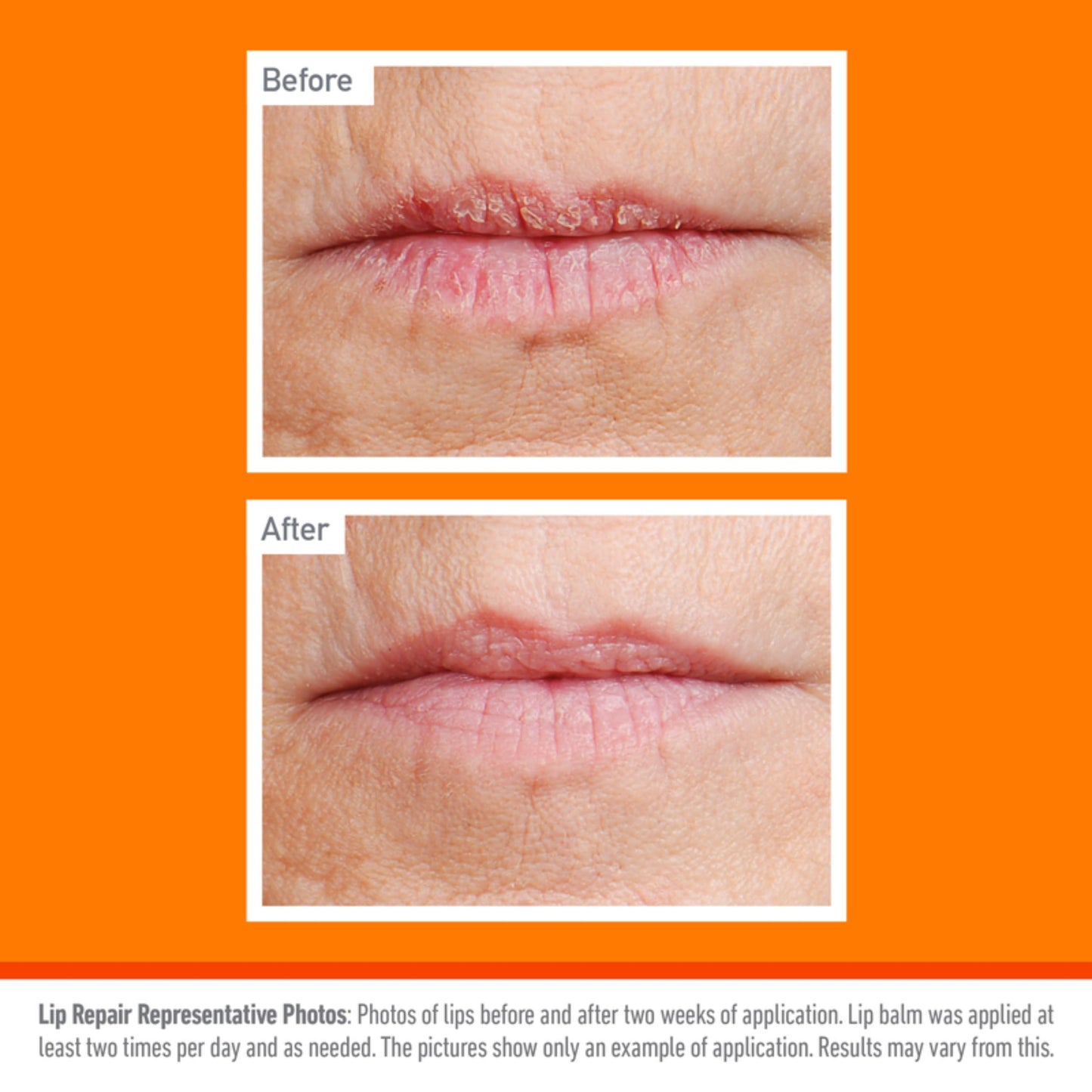 Lápiz de Reparación de Labios O'Keeffe's Refrigeración 6 Unidades