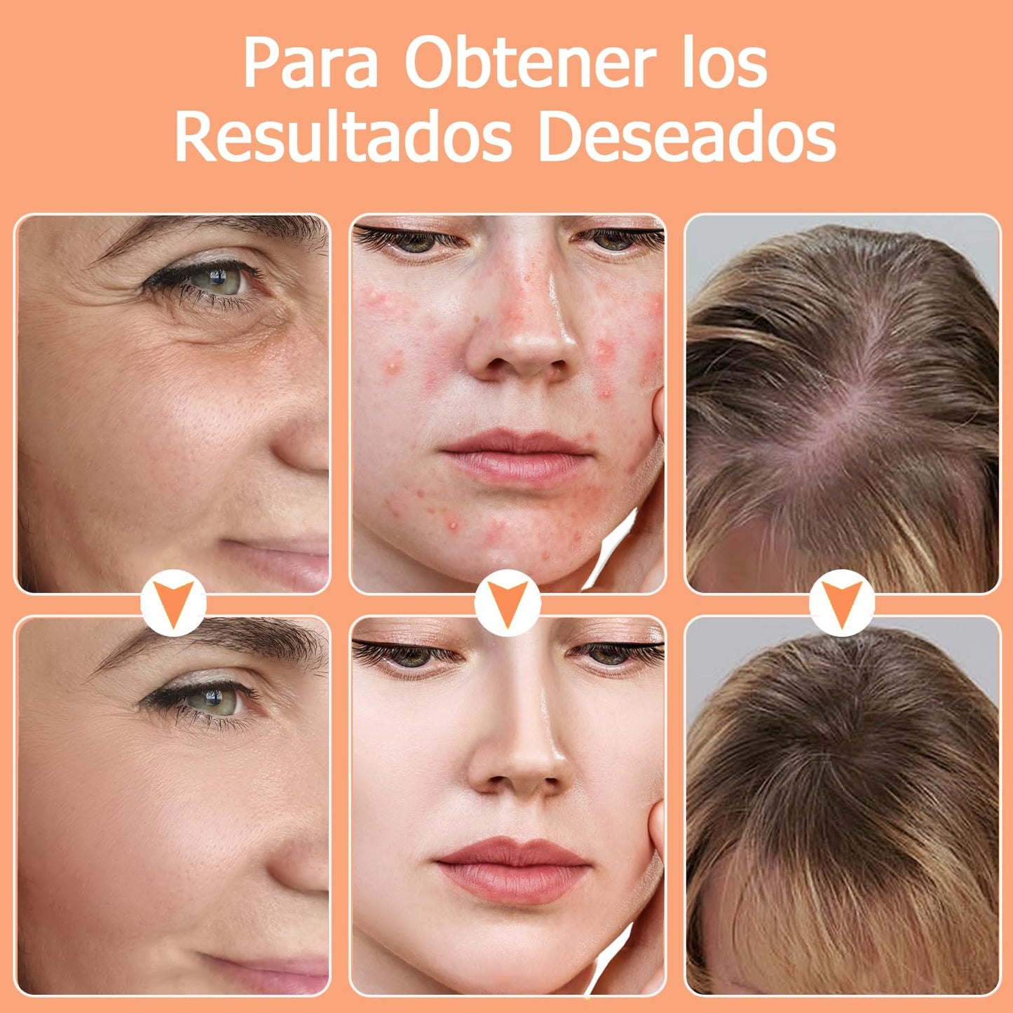 Máquina de Alta Frecuencia Facial y Corporal Profesional - Radiofrecuencia y Ozono con 4 Varitas de Neón | Tratamiento Facial, Corporal y Capilar | Reduce Arrugas, Ojeras y Flacidez | Estimula Crecimiento del Cabello