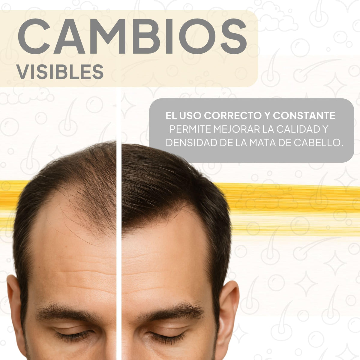 Shampoo Crecimiento Cabello Anti Caída Ingredientes Naturales Alopecia Gran Eficiencia