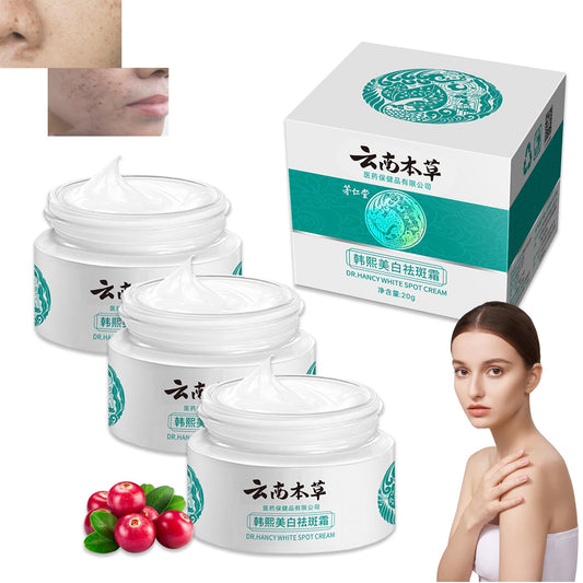 Crema de manchas amarillas japonesas kirozi, crema japonesa kirozi, crema de manchas claras blanqueadoras, crema de hierbas de yunnan, crema de pecas blanqueadoras de hierbas de Yunnan (3piezas)