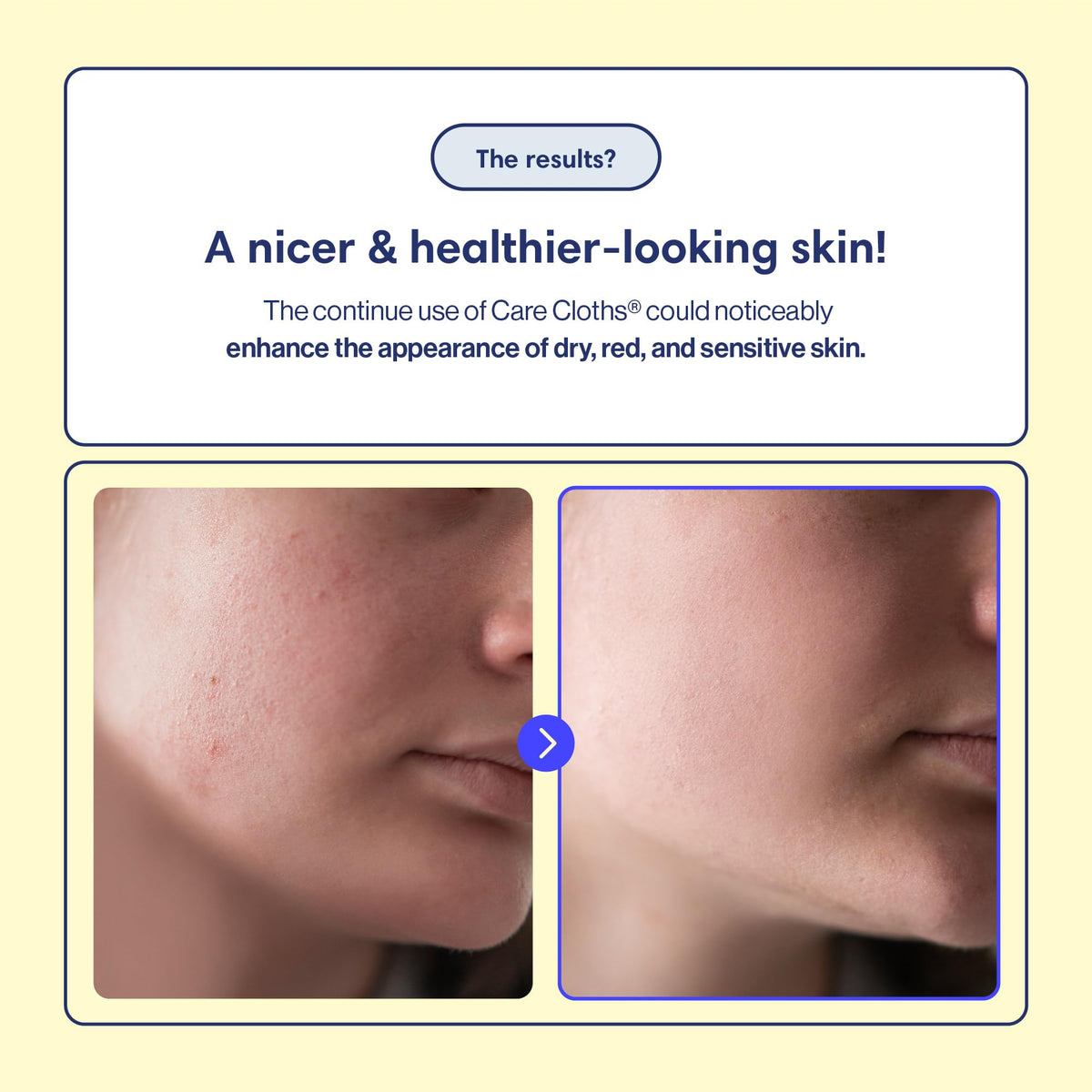 EZPULL Toalla Facial Desechable Ultra Deluxe, Sin Fragancia Ni Pelusa, 100% Biodegradable, Tacto Suave, 40 Unidades, Tamaño Mini (7,87" X 7,87"). Paños De Cuidado.