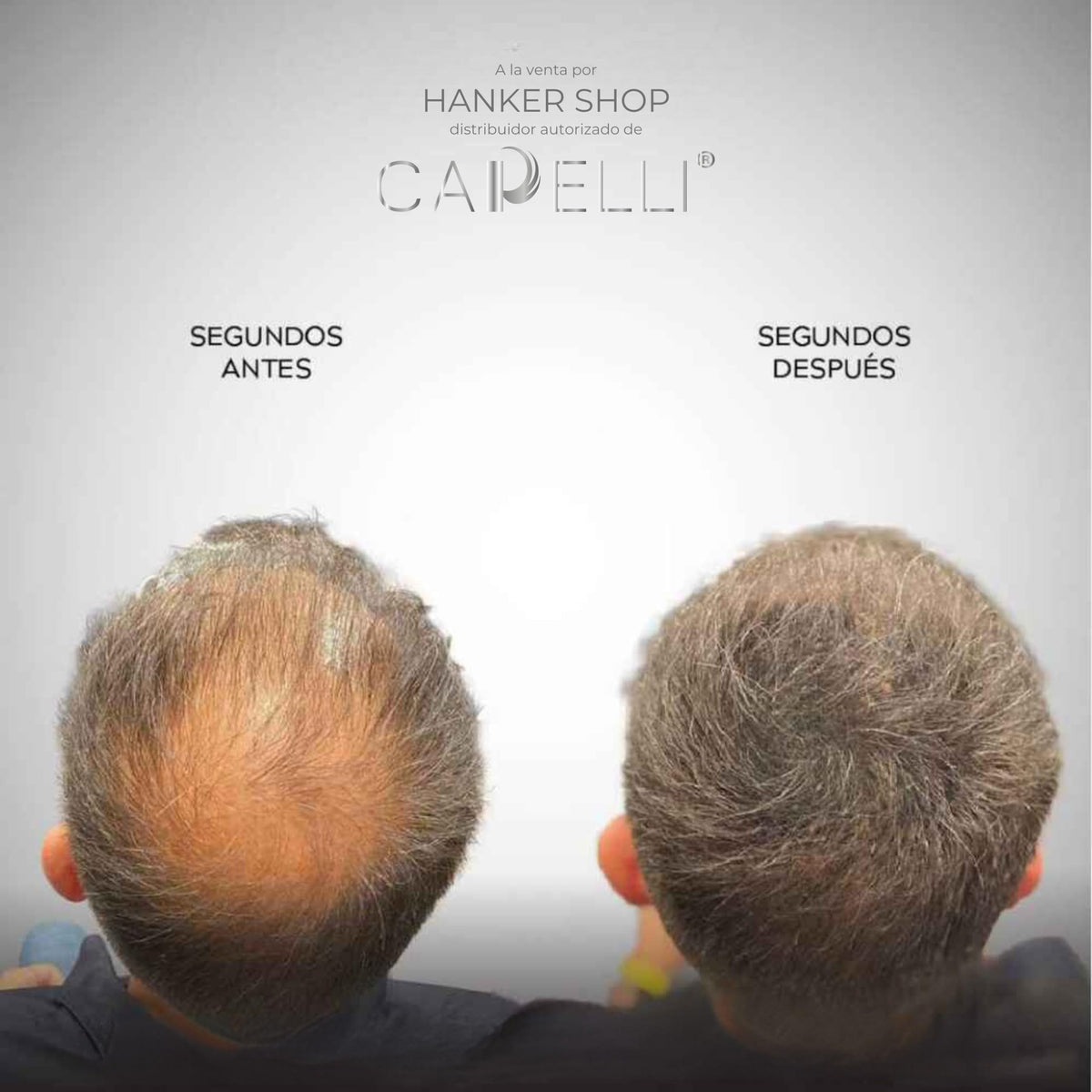 Fibras Capilares Capelli Castaño Claro Polvo para Calvicie y Alopecia