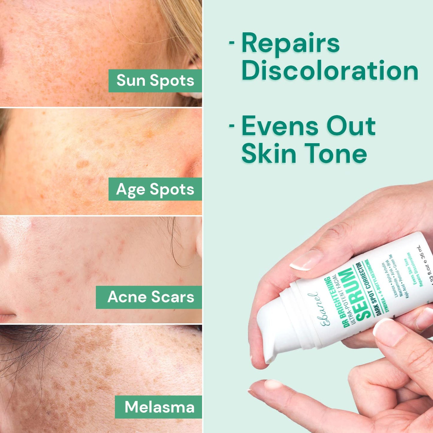 Ebanel Removedor de manchas oscuras para suero facial aclarador de la piel corrector de manchas oscuras para tratamiento de melasma e hiperpigmentación con ácido azelaico, ácido kójico, alfa arbutina