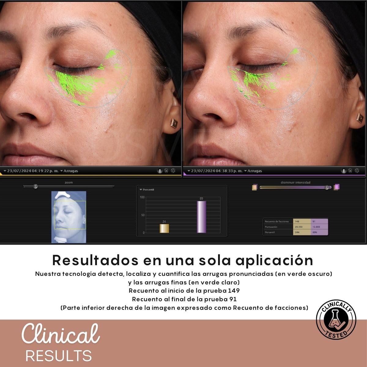 Lifting Facial Serum