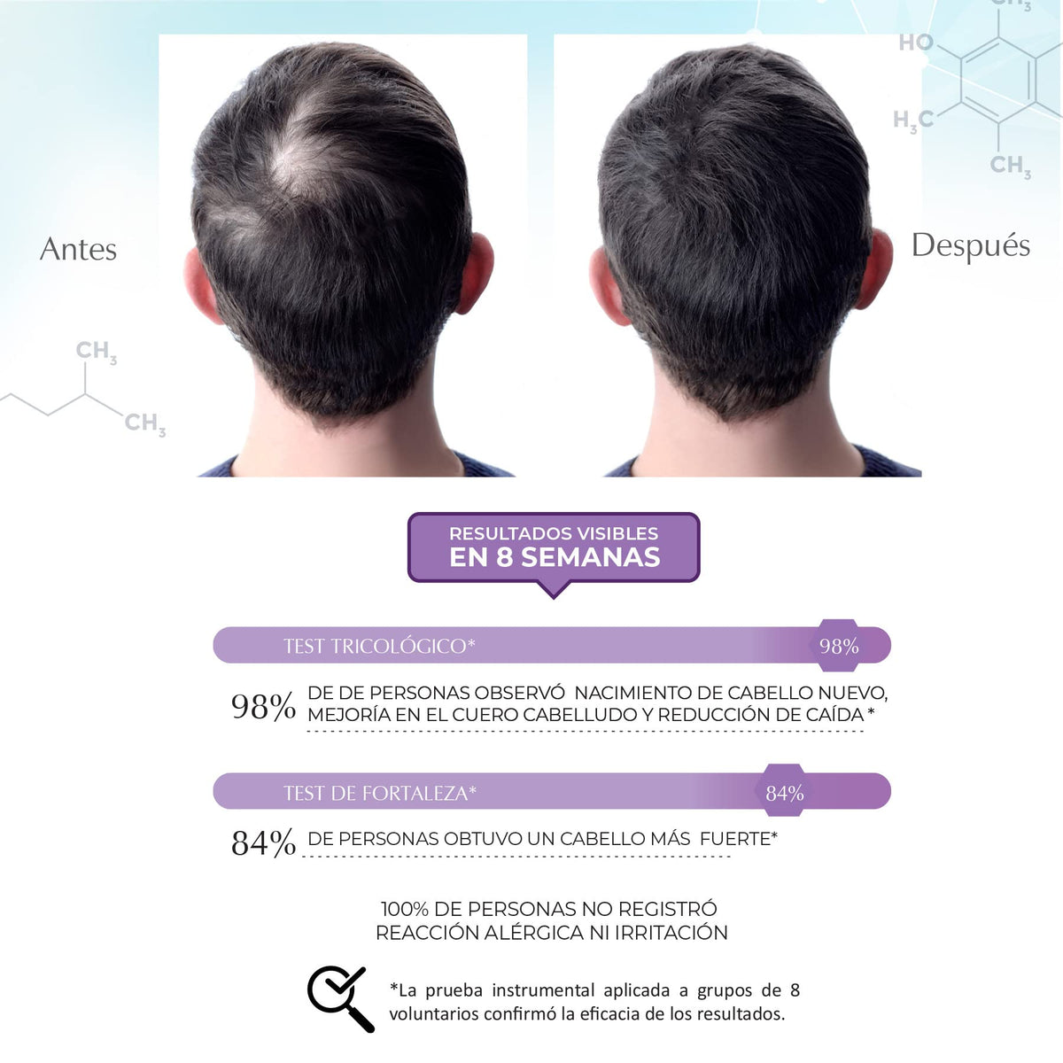 Kit Shampoo y Loción Anticaída Marie d’Argan Blanco con Procapil y Argán para Fortalecer y Nutrir el Cabello
