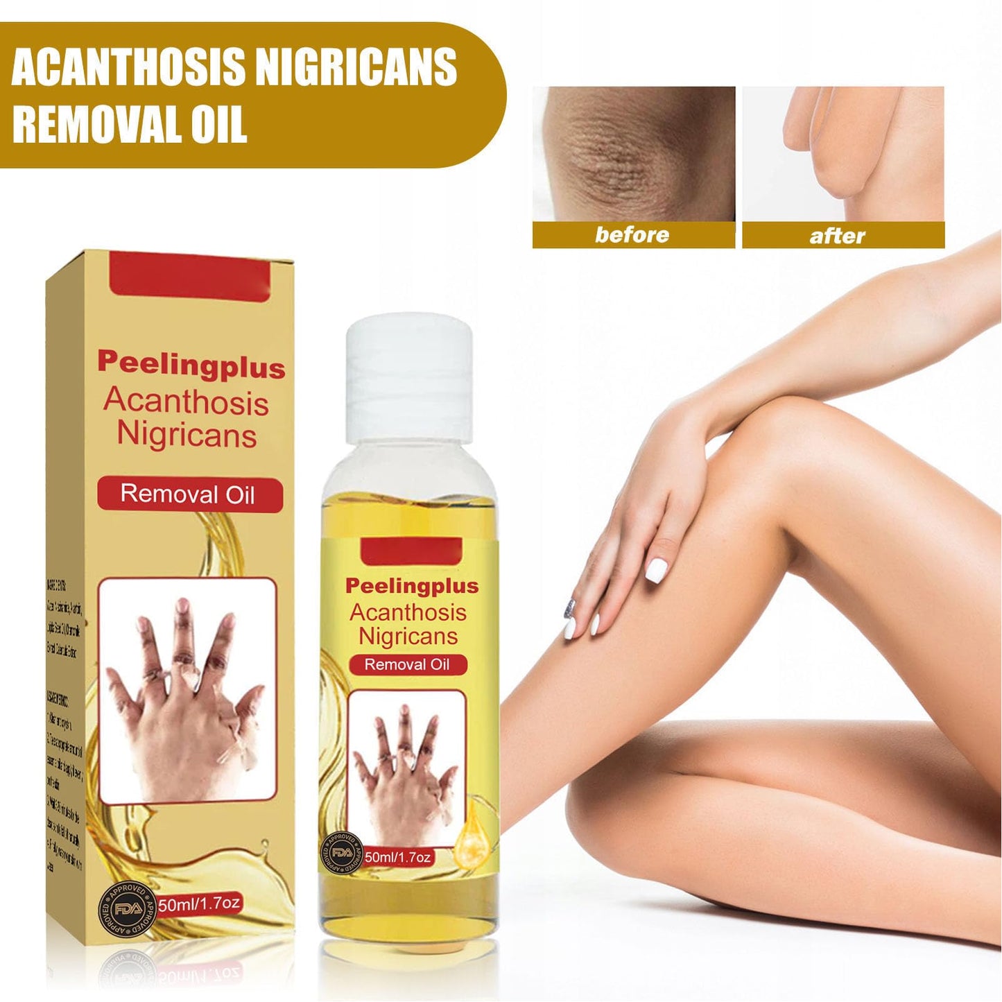 Dioche 3 Piezas 50ml Aceite Exfoliante, Acantosis Nigricans Peeling Aceite para Piel Oscura, No Graso Aclara el Tono de la Piel Corrector de Manchas Oscuras Aceite Peeling