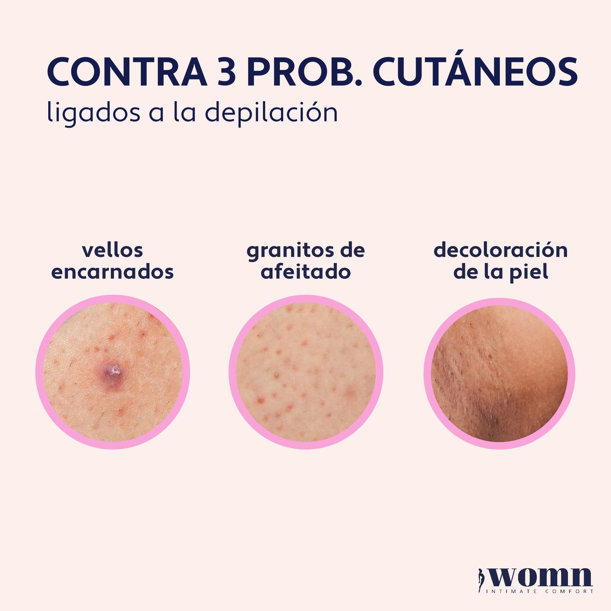 womn Intimate Comfort SUERO VELLO ENCARNADO - Contra vellos encarnados, granos de afeitado y manchas en la piel, 50 ml