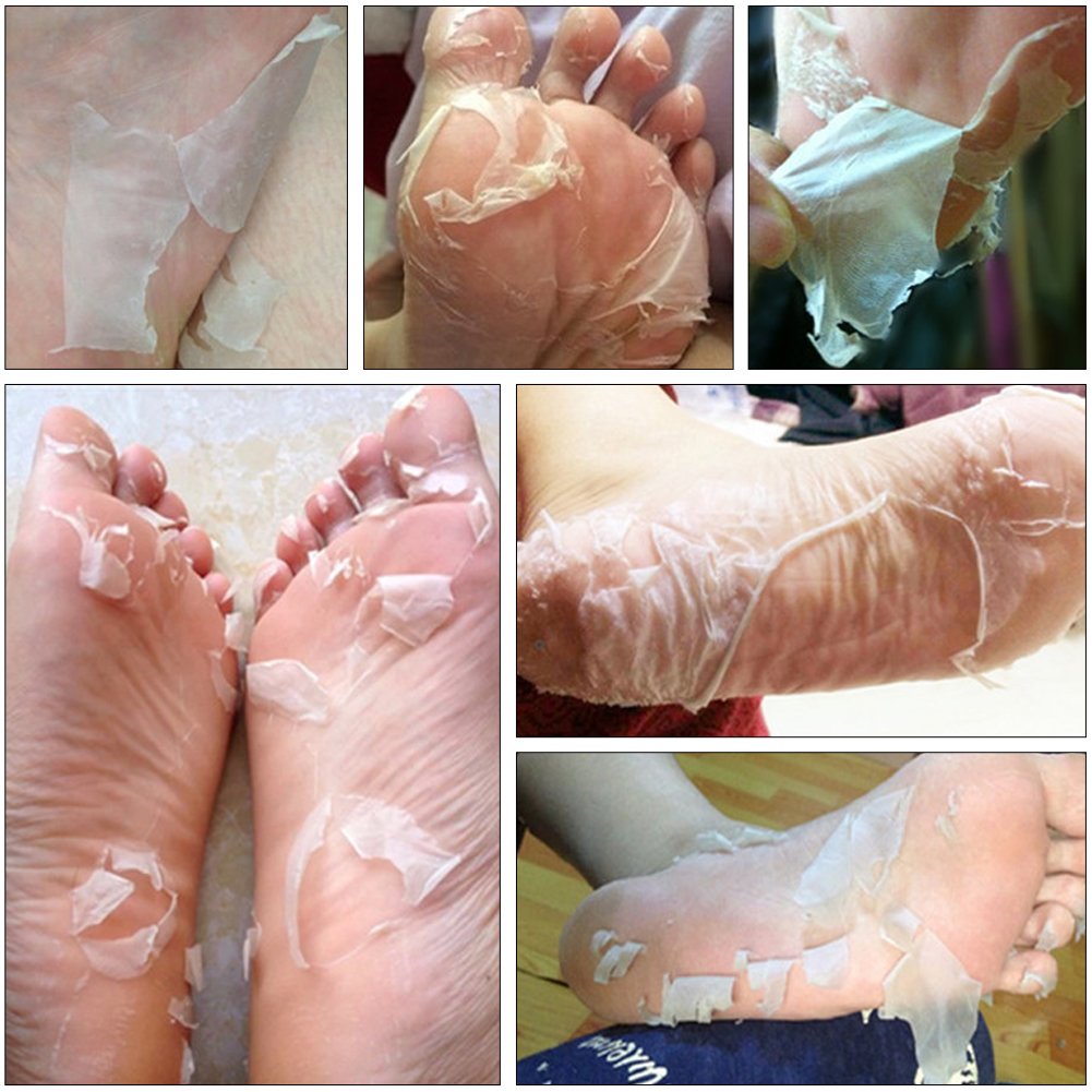 LANBENA | Kit 2 Pares de Mascarillas Exfoliantes De Pies Lanbena Elimina Piel Muerta Suaviza El Talón Y Lo Aclara