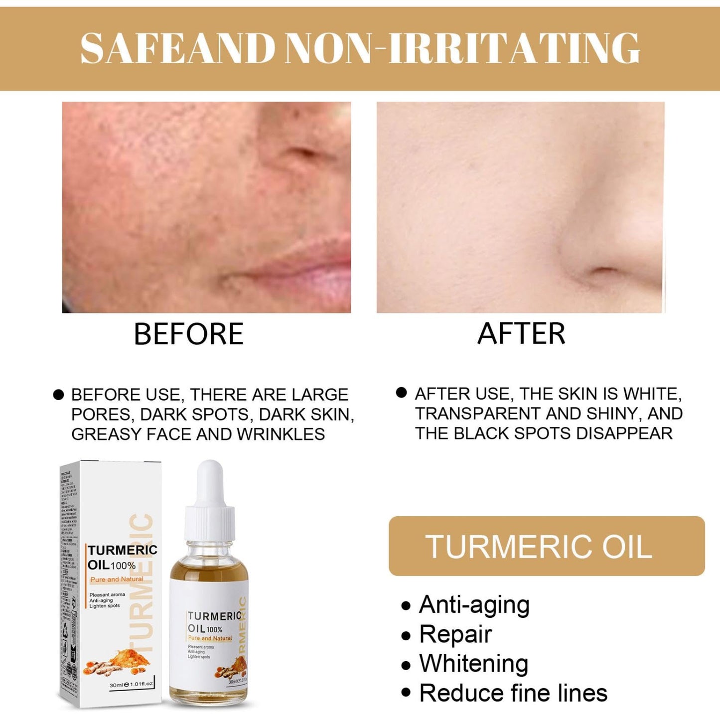 Cúrcuma Serum Facial Reparador, Suero Corrector De Manchas Oscuras De Cúrcuma, Cúrcuma Natural Piel Brillante Suero Hidratante Reparador de Manchas Oscuras, Hidrata La Piel Apagada Y Seca (3PCS)