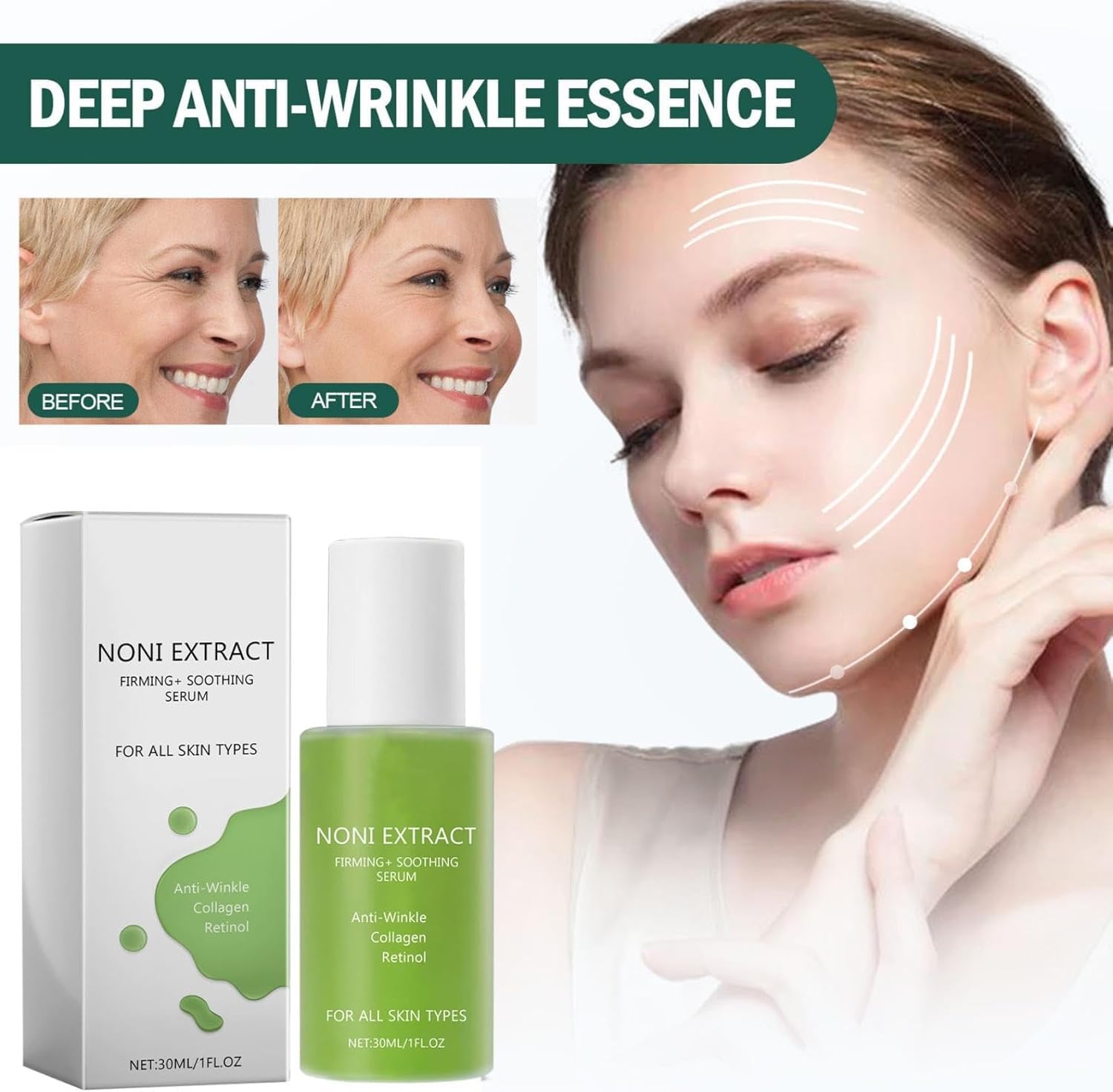 Serum de Fruta Noni 3 en 1: Ampolla Energizante, Tónico Equilibrante e Hidratante Facial. Para Todo Tipo de Piel. 30ml/1fl.oz. Beneficios Antioxidantes y Nutritivos.
