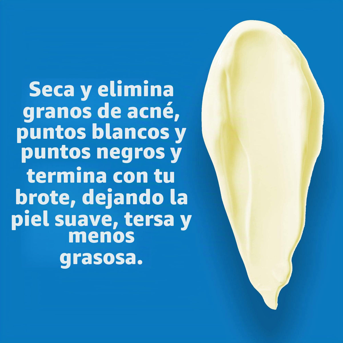 De La Cruz- Ungüento de azufre al 5%: tratamiento para el acné quístico en rostro y cuerpo: mascarilla diaria de tratamiento localizado de 10 minutos