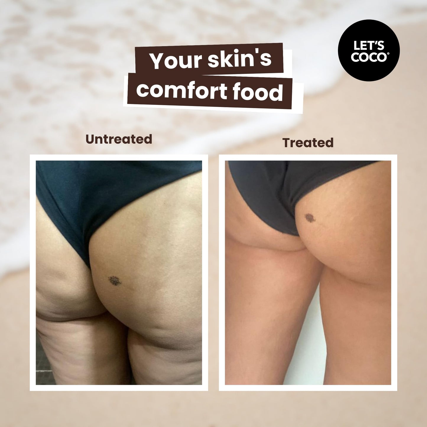 LET'S COCO | Kit Tonificante Anti-Celulitis (Let’s Coco Black + Golden Body Oil) - Exfoliante Corporal de Café, Anti-Celulitis, Para Uso en Todo el Cuerpo y Aceite Corporal de Jojoba y Sándalo (Black + Golden Body Oil)