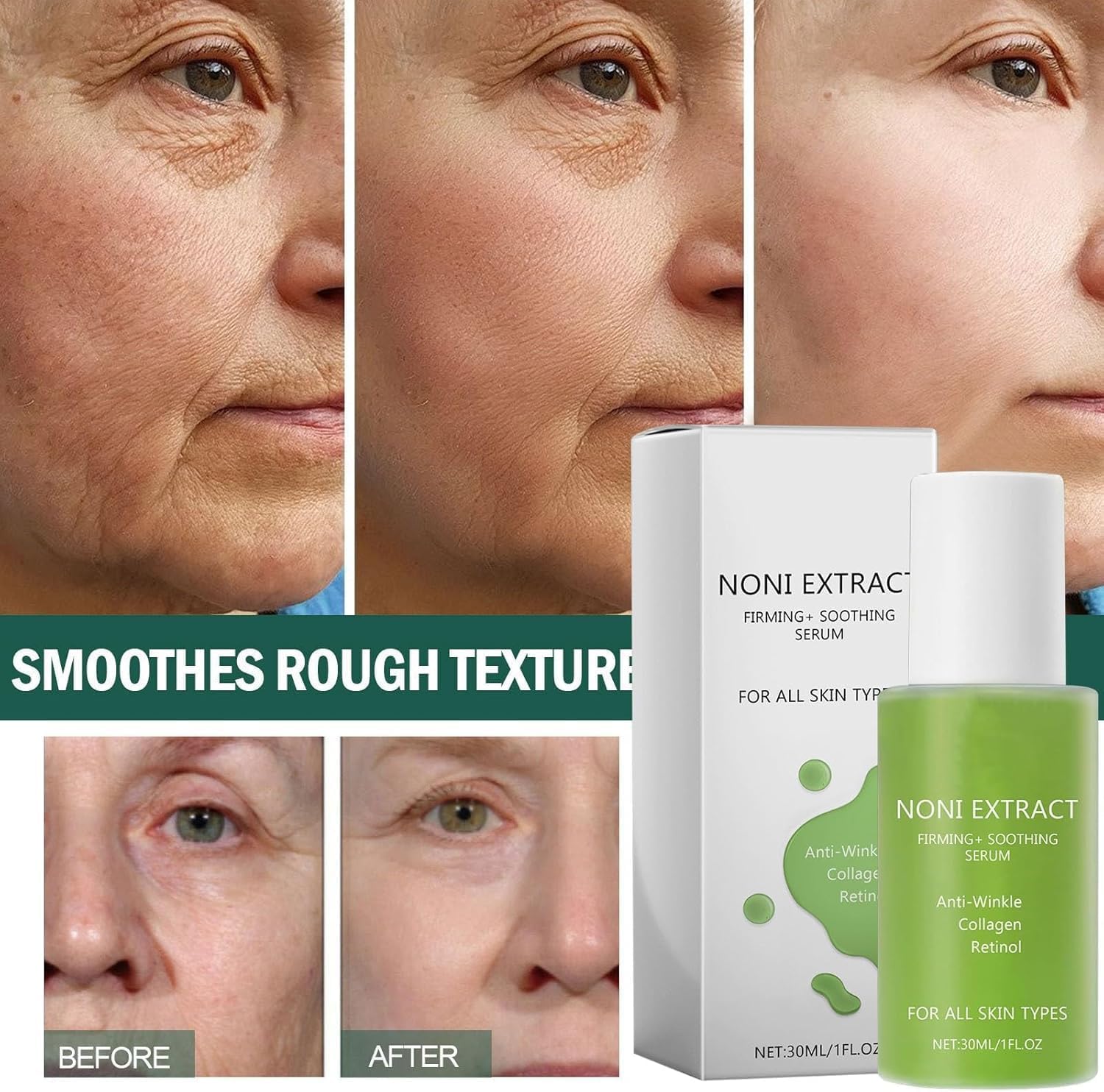 Serum facial de extracto de fruta de Noni de 30ml - Antiedad y reafirmante - ¡Modela tu piel!