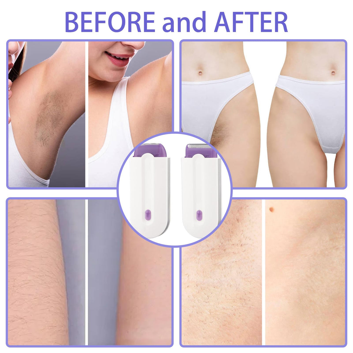 KAILIYA - Herramienta de eliminación de vello suave y sedosa, portátil, indolora, recargable, depiladora, suave al tacto, para quitar el cabello aplicable a cualquier parte del cuerpo de mujeres y