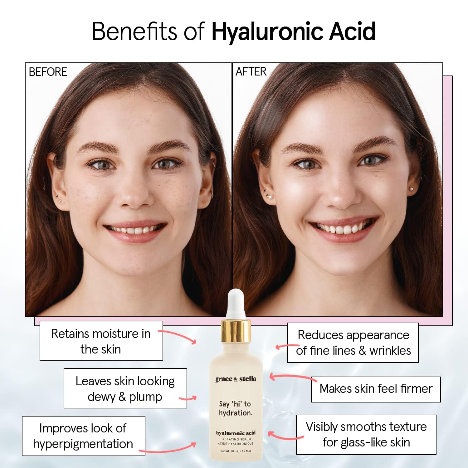 Suero de ácido hialurónico – Vegano – Suero de ácido hialurónico para la cara, ácido hialurónico para hidratar y eliminar líneas finas + arrugas, aumentar el colágeno – Saluda a la hidratación con grace and stella (1.7 onzas)
