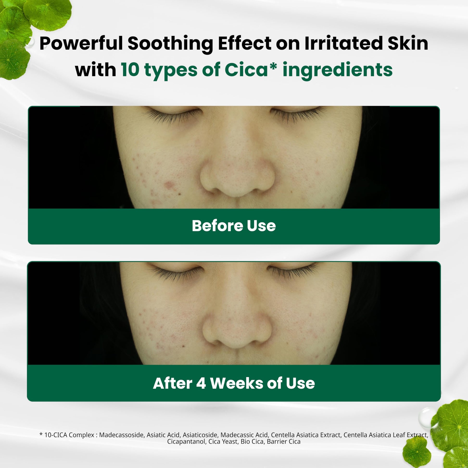 Dr.G NEW RED Blemish Clear Soothing Cream (70ml 2.36 oz) Gowoonsesang Cosmetic, Moisturizing Recovery Cream