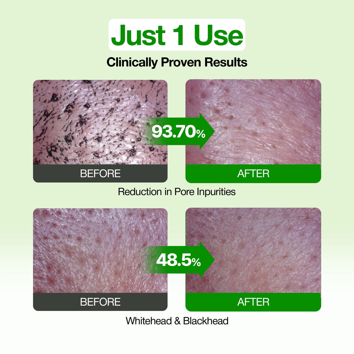 BSVI FULLY Green Tomato Clay Mask Cleanser, Pore Purifying with 49% Green Tomato Extract, Sebum & Clogged Pore Care, Exfoliation, Fragrance-Free, Vegan & Dermatologically Tested, 4.05 fl.oz