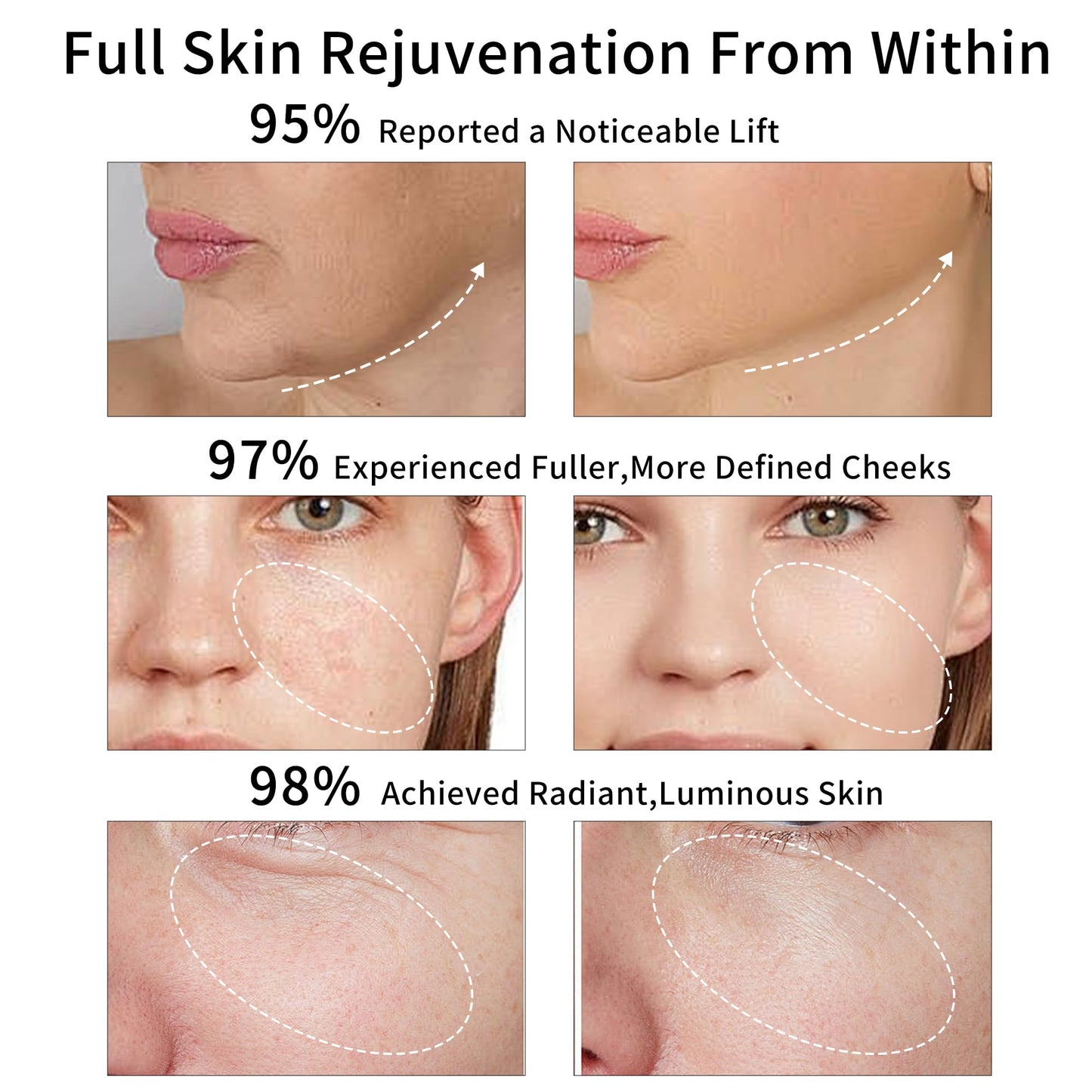 Dispositivo de Tonificación Facial con Luz Roja Era of Nature – Tecnología de 3 Modos de Microcorriente y Luz Roja – Eleva, Apreta e Infunde – Herramienta Compacta de Rejuvenecimiento de la Piel con