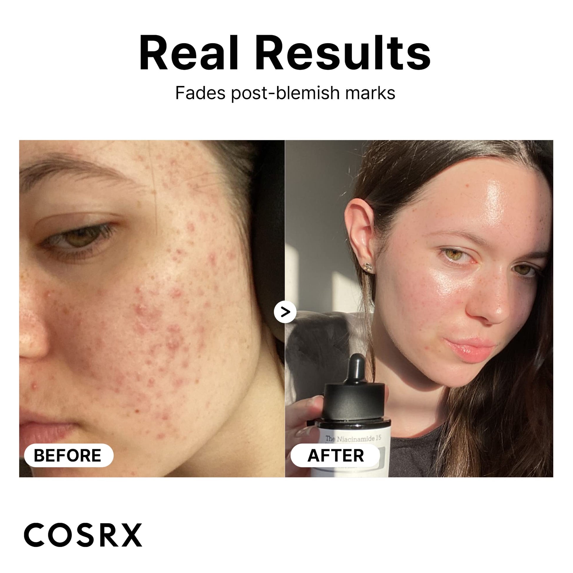 COSRX Niacinamide 15% Face Serum with Zinc 1%, Minimizing Pores & Sebums, Blemish Treatments for Discoloration, Dark Spots, Enlarged Pores, Anti-aging, 0.67 fl.oz / 20 ml, Animal Testing-Free, Artificial Fragrance-Free, Parabens-Free