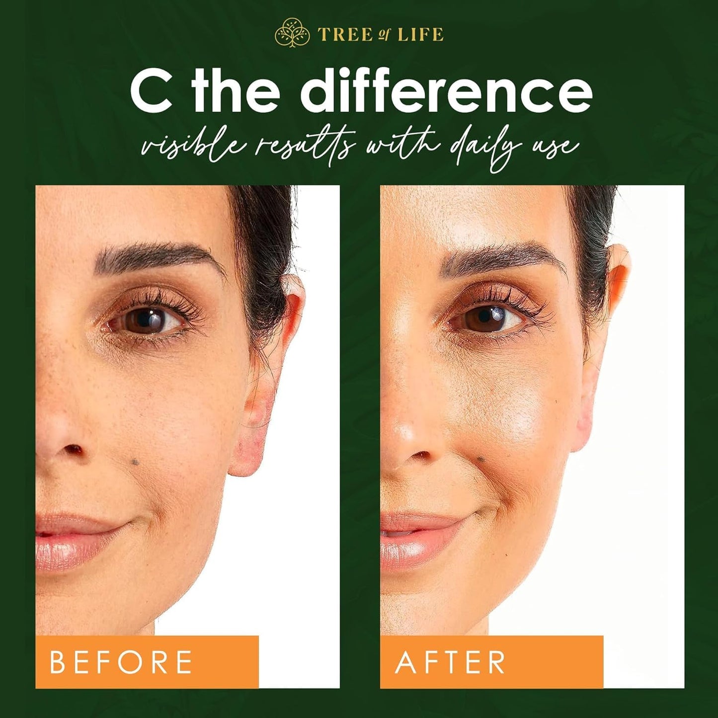 ToLB Vitamin C Serum for Face with Hyaluronic Acid - Anti Aging Anti Wrinkle Facial Serum with Natural Ingredients - Paraben Free, Vegan - Best Vitamin C with Hyaluronic Acid Serum for Skin - 1 fl oz