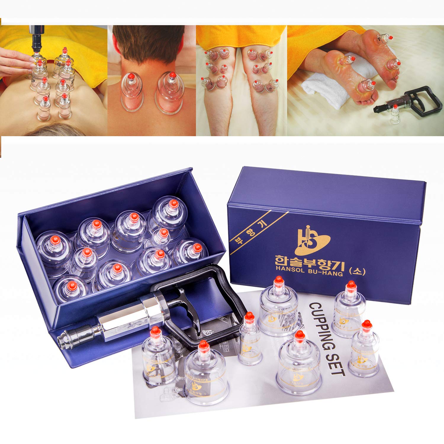 Hansol Professional Cupping Therapy Equipment Set with pumping handle 10 Cups & English Manual (Made in Korea) by Hansol Medical Equipment