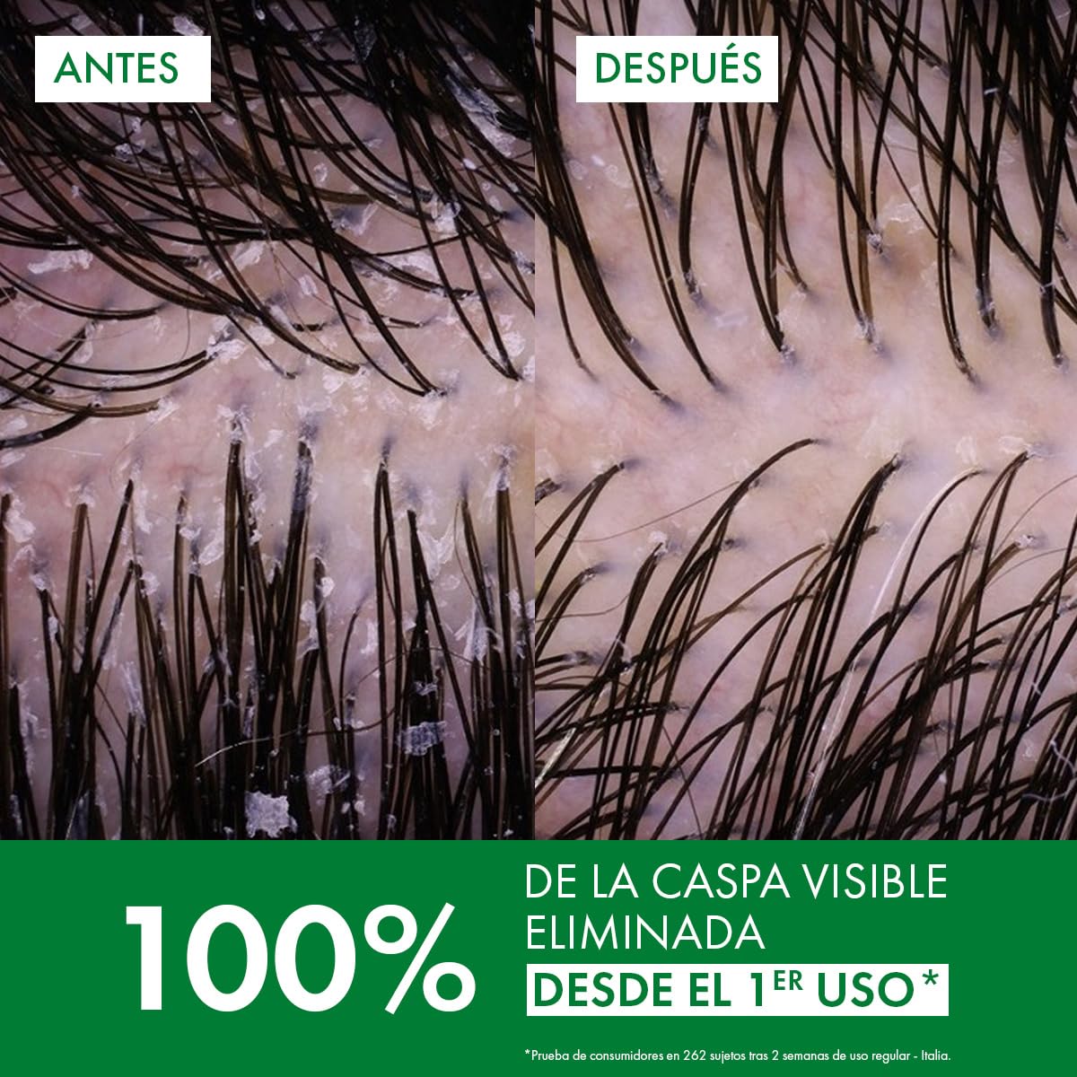 Vichy Dercos Shampoo Dermatológico Anti-Caspa Cabello Normal a Graso 390ml
