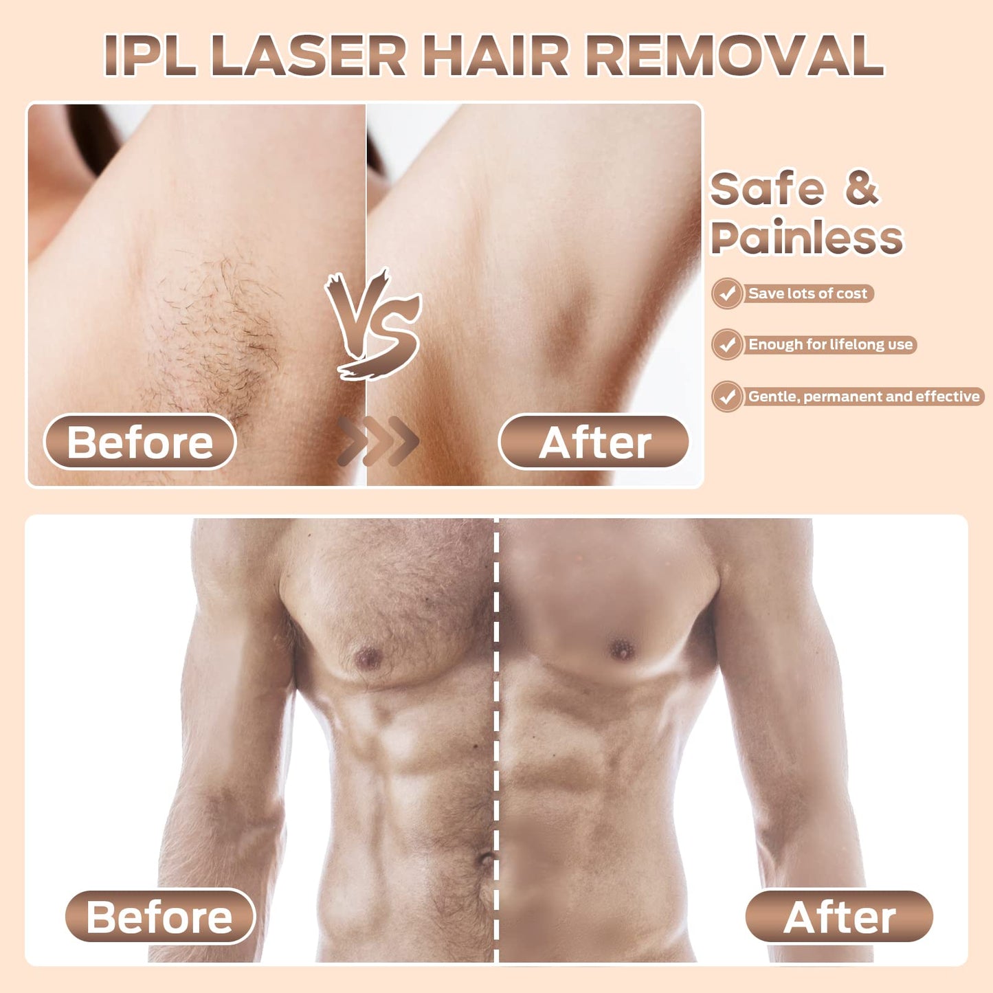 Depilación láser, depilación IPL en casa para mujeres y hombres, removedor de vello permanente sin dolor actualizado a 999.900 destellos dispositivo de depilación para axilas, labios, bikini todo el cuerpo