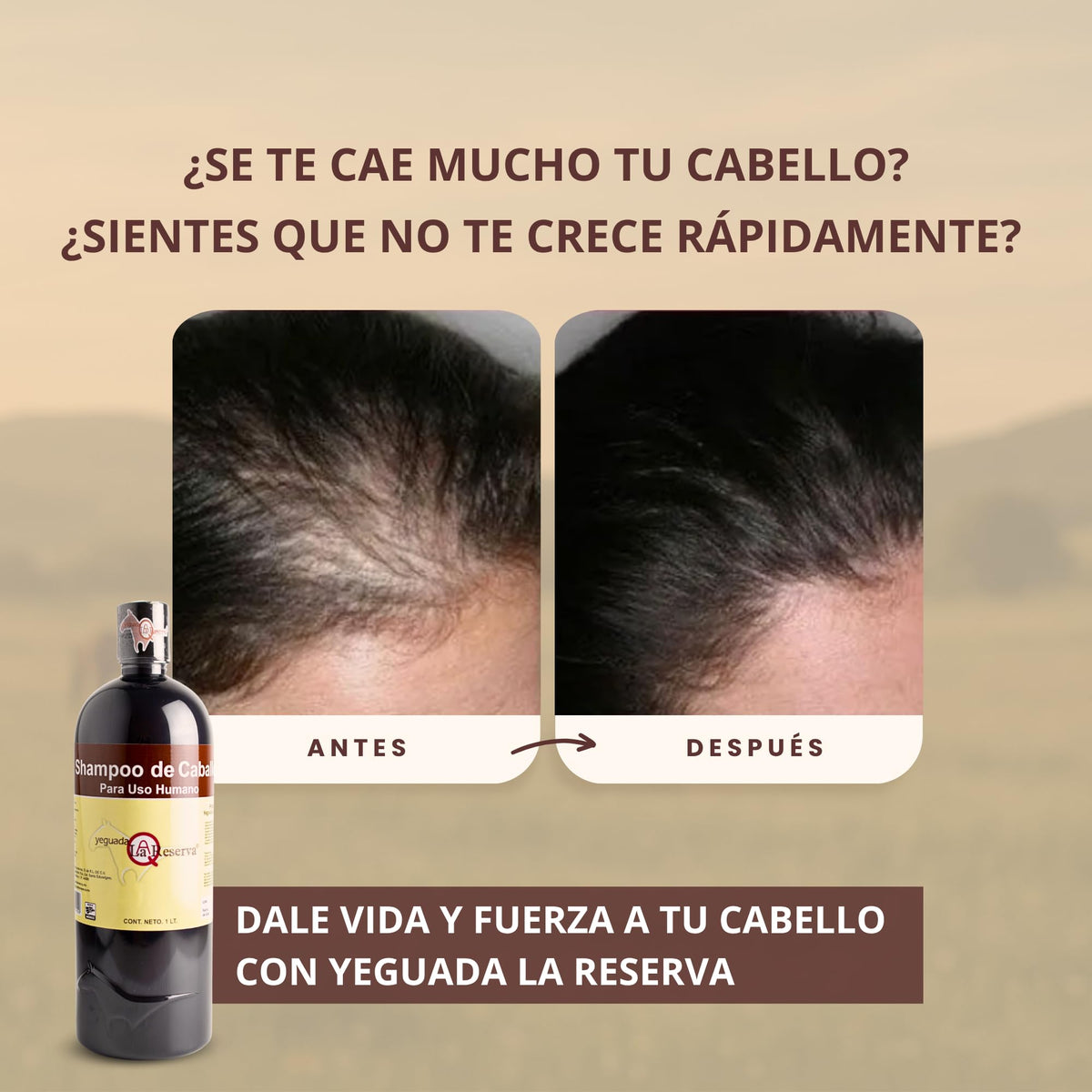 Shampoo Yeguada La Reserva Negro con Colágeno y Vitamina E para Hidratación y Fortalecimiento del Cabello Anticaída Unisex Adultos