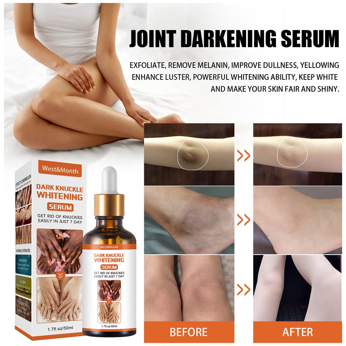 Serum Aclarador de Piel con Antioxidantes y Vitaminas para Codos y Rodillas - Tratamiento Natural - Corrige Acanthosis Nigricans