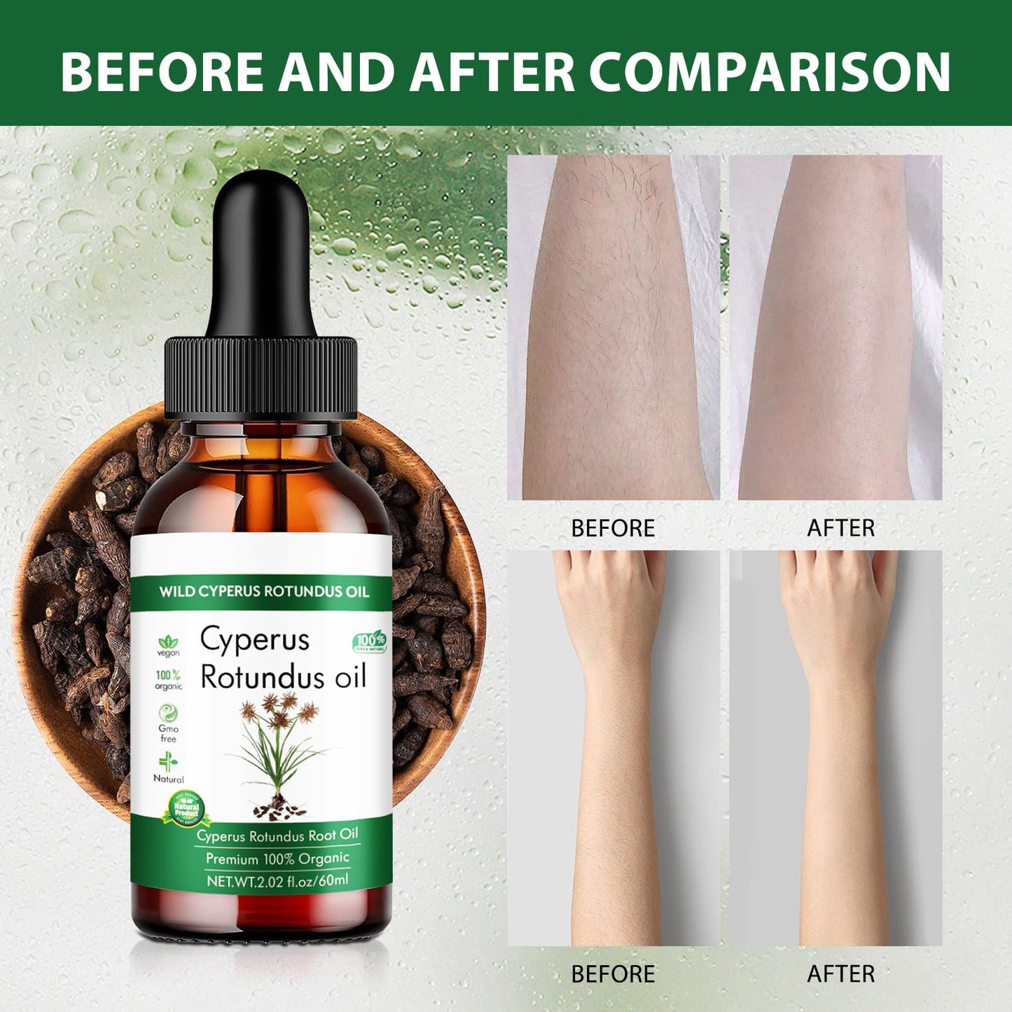 Aceite de Nuez Orgánico para Hidratación Natural de Piel - Cuidado Premium para una Piel Suave y Radiante 🌿